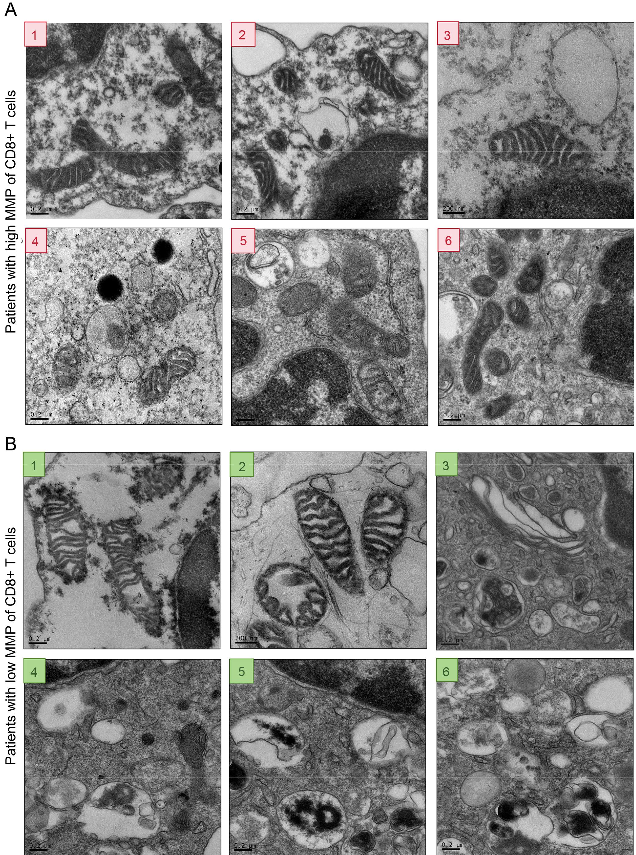 CD8<sup>+</sup> T-cell mitochondria observed by transmission electron microscopy.