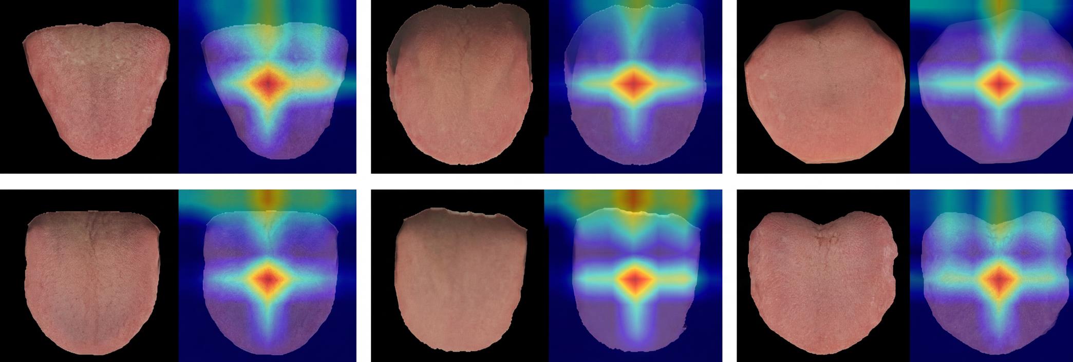 Visualization of tongue features based on EigenCAM.