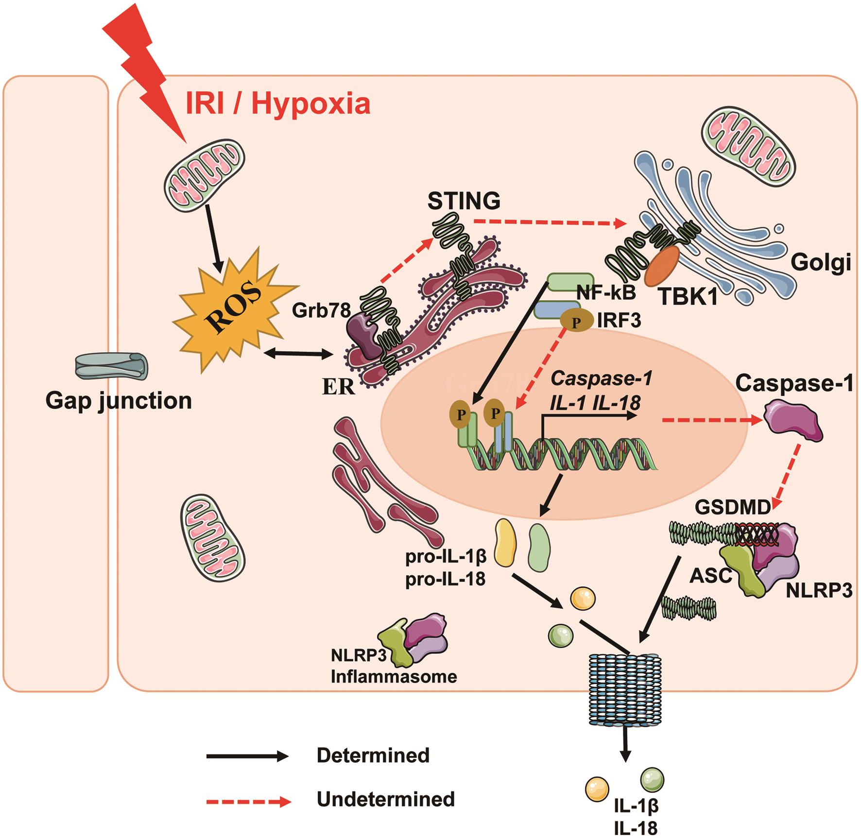 Schematic model of the role of ER stress and STING/IRF3 in pyroptosis in myocardial I/R injury.