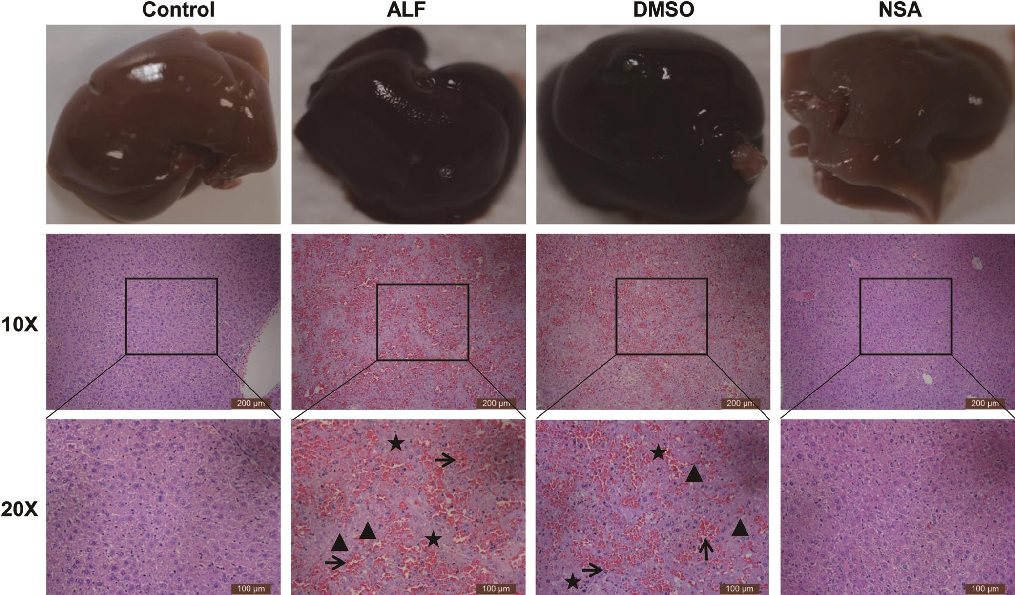 Effects of NSA on liver tissue pathology in different groups.