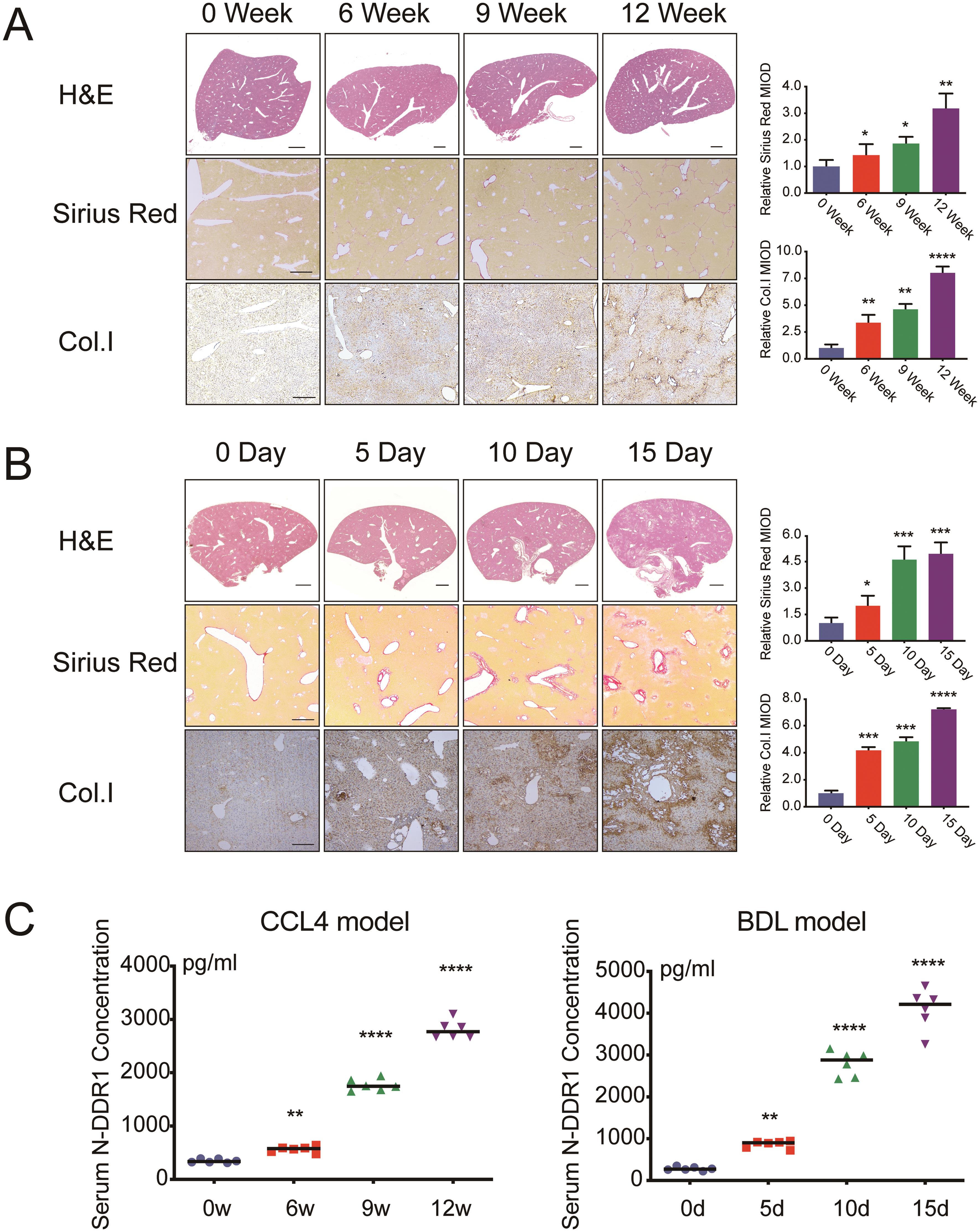 Type I collagen deposition and serum N-terminal DDR1 in the CCl4-induced and BDL mouse model.
