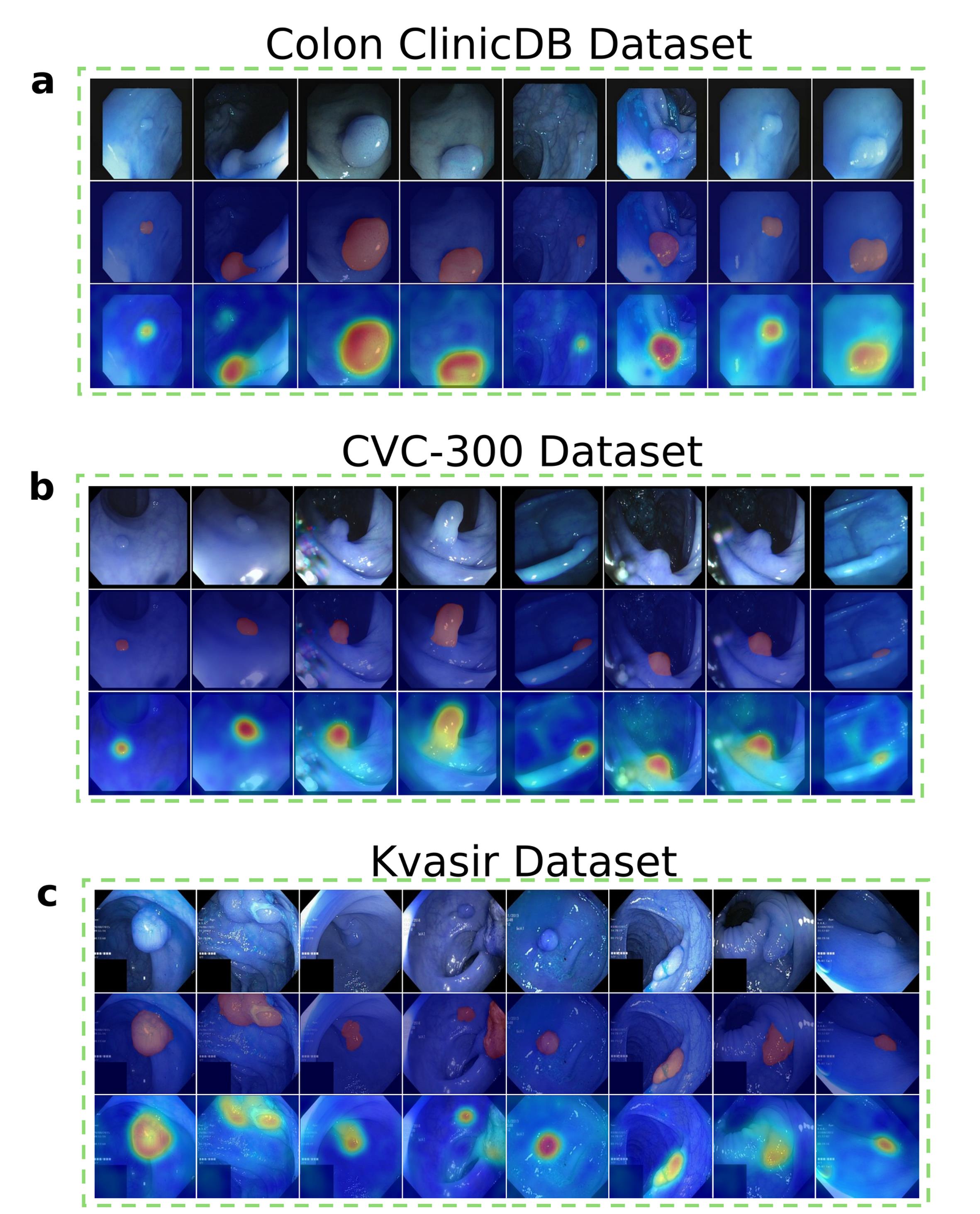 Qualitative zero-shot lesion localization on three unseen target datasets: (a) CVC-ClinicDB, (b) CVC-300, and (c) Kvasir-SEG.