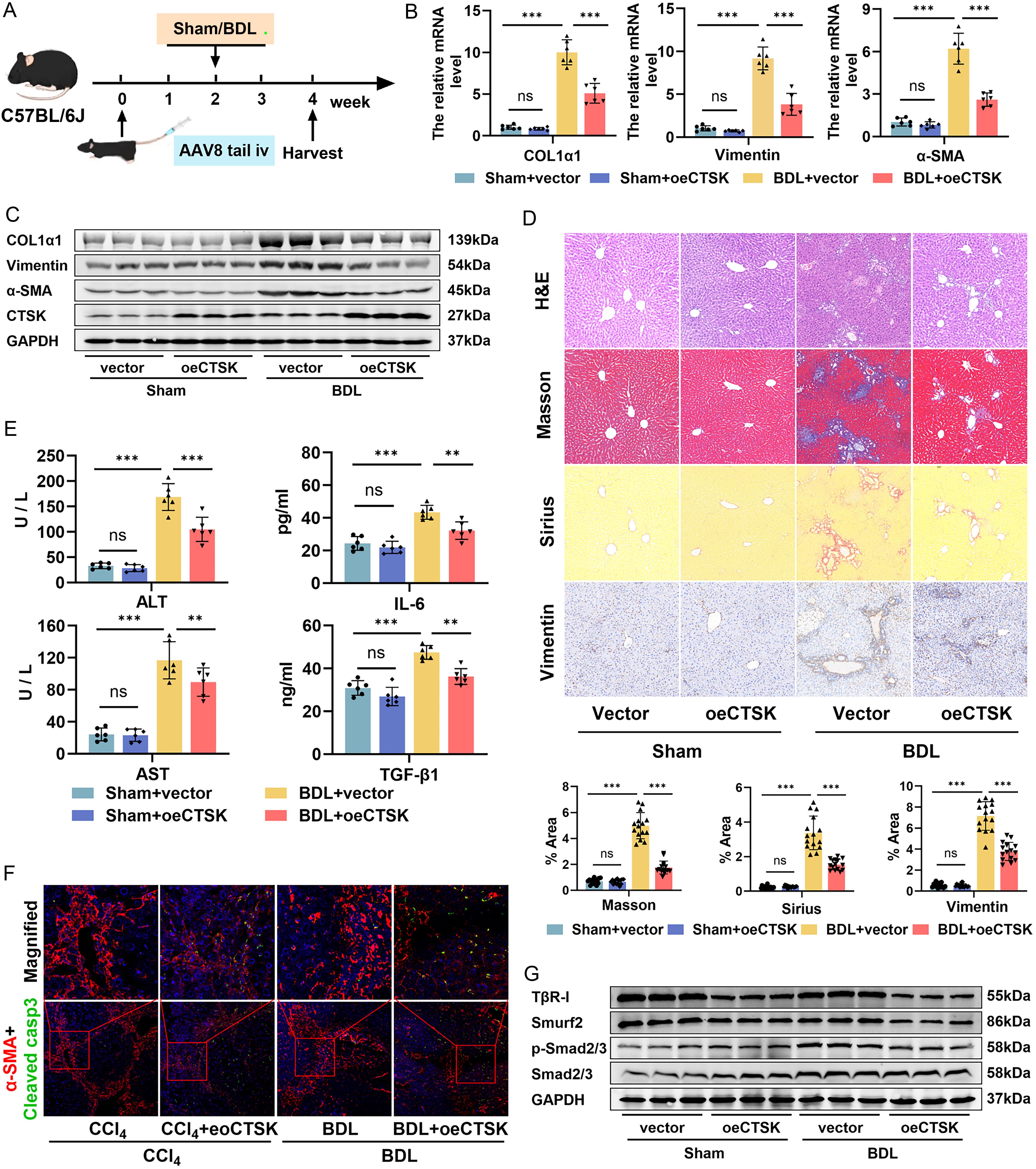 Analysis of BDL-induced cholestatic fibrosis in mice overexpressing CTSK.