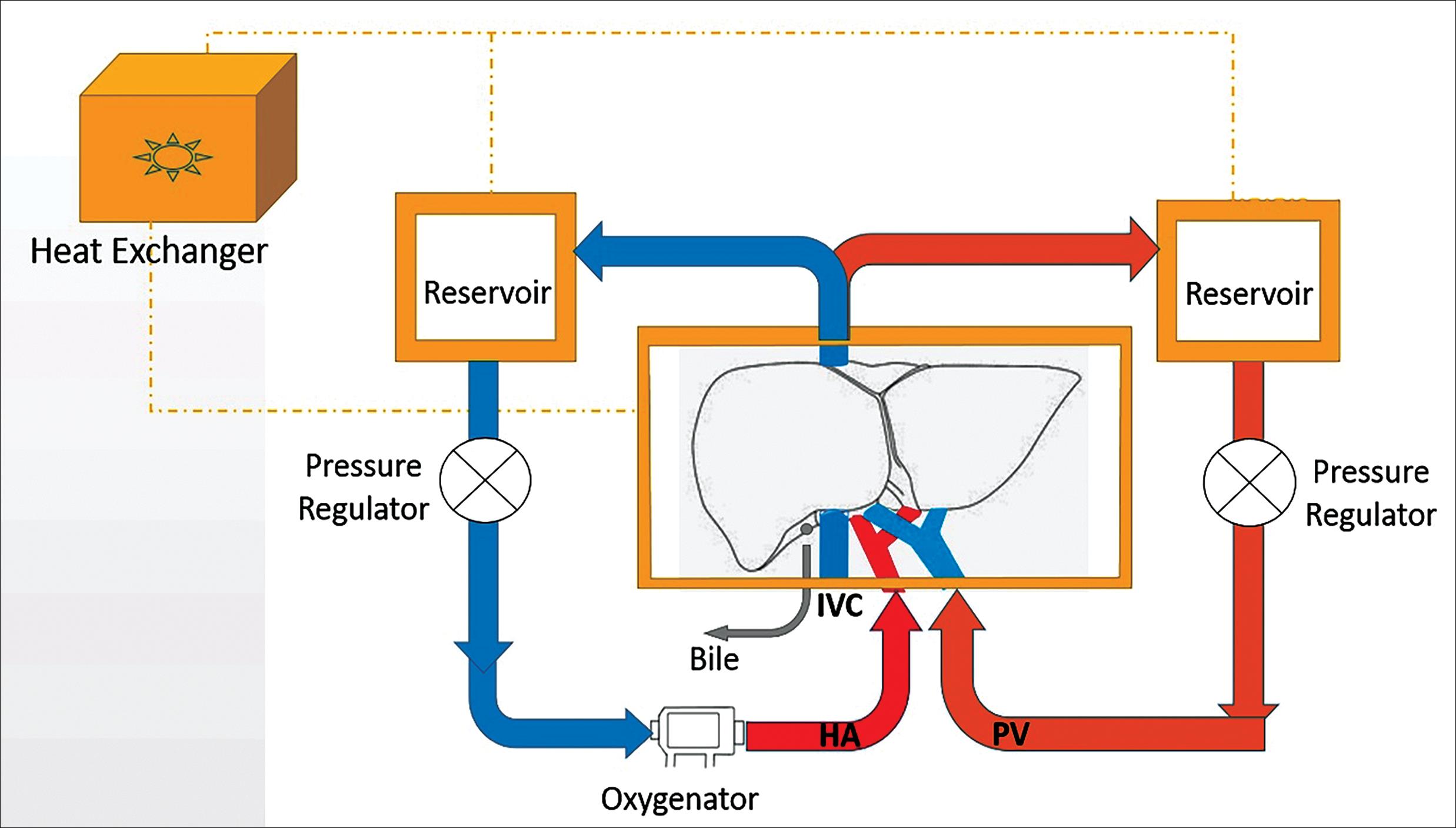 Schematic of a normothermic <italic>ex-vivo</italic> liver perfusion circuit.