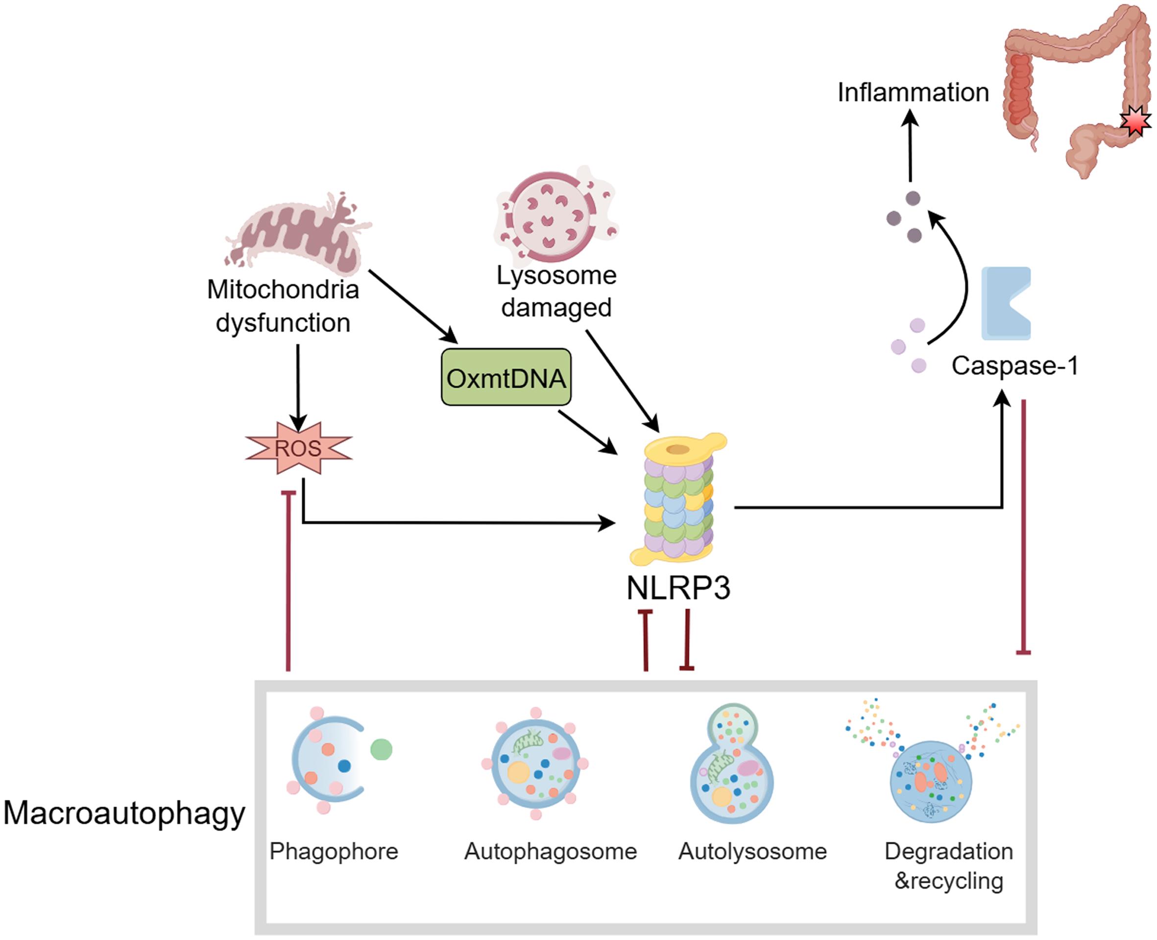 Mechanism of interaction between NLRP3 and autophagy: Oxidized mitochondrial DNA (OxmtDNA), released by damaged mitochondria and ROS, along with damaged lysosomes, activates the NLRP3 inflammasome.