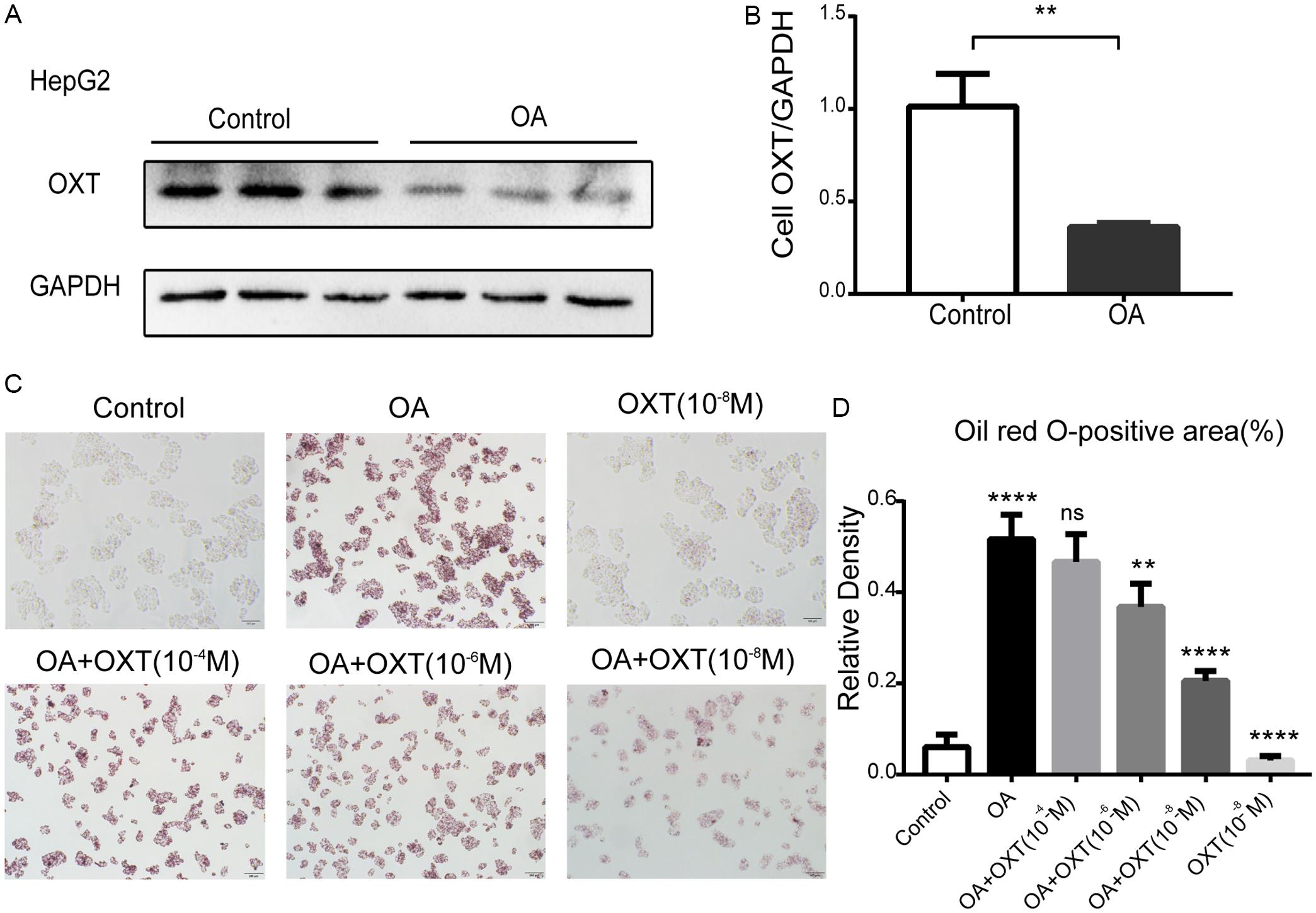 The effects of OXT on lipid accumulation in OA-treated HepG2 cells.