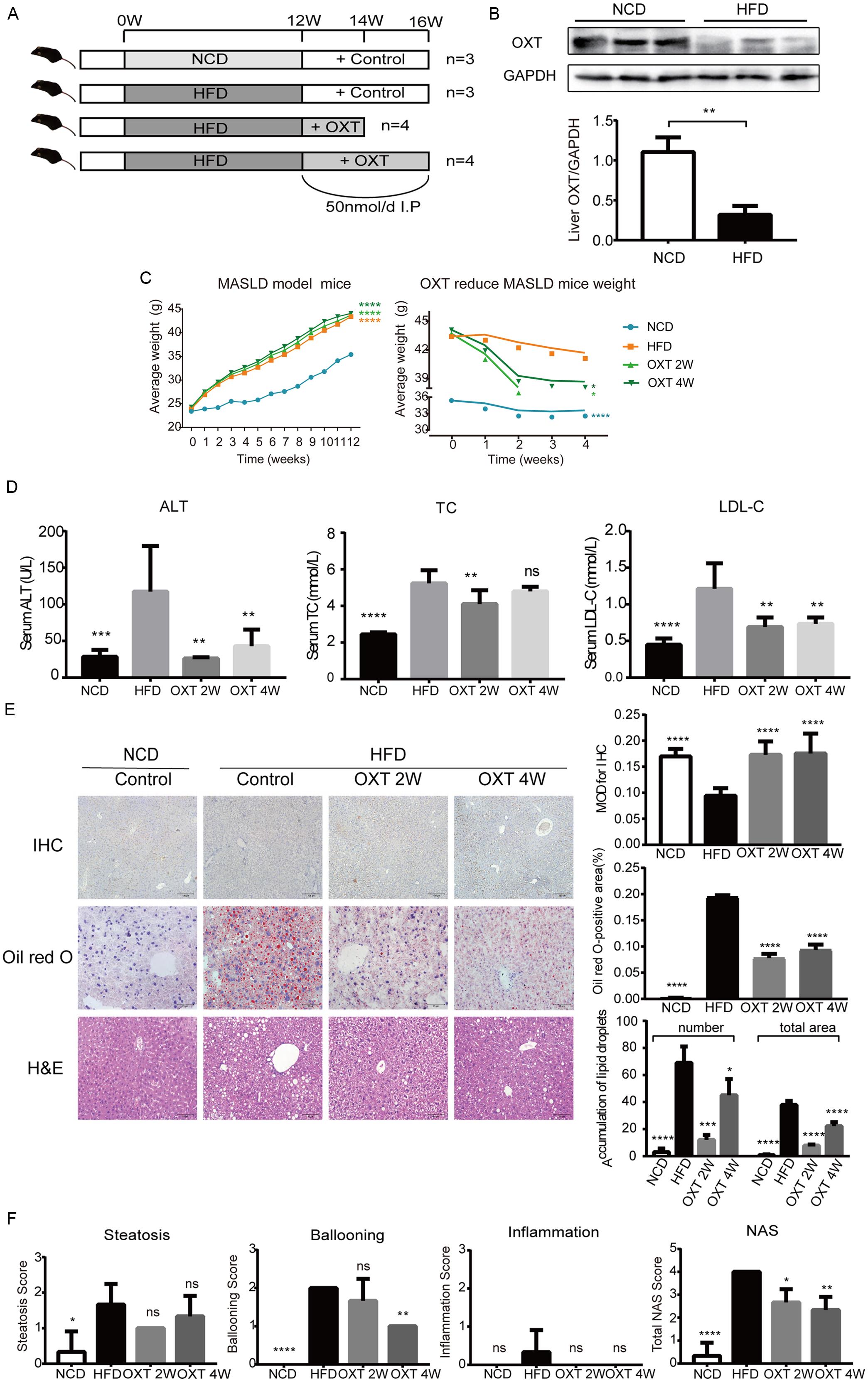 The effects of OXT on hepatic steatosis in HFD-fed mice.
