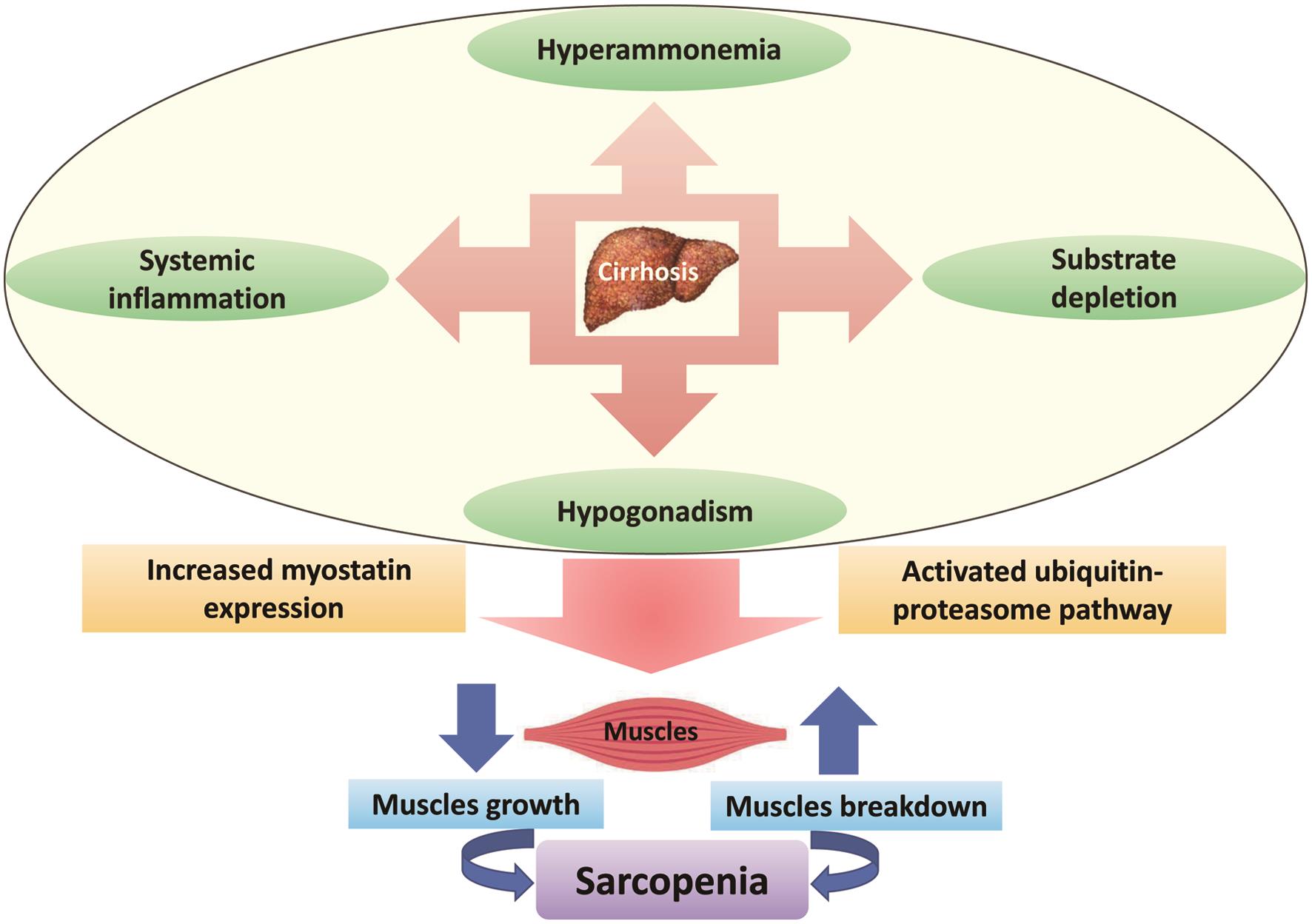 Sarcopenia in Chronic Liver Disease: A Metabolic Perspective