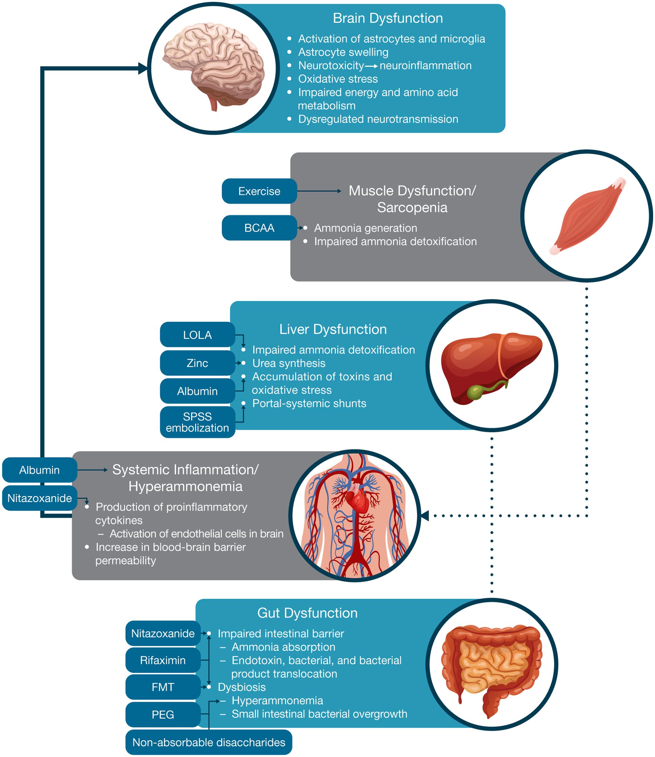 Pathophysiology of HE and therapeutic targets.