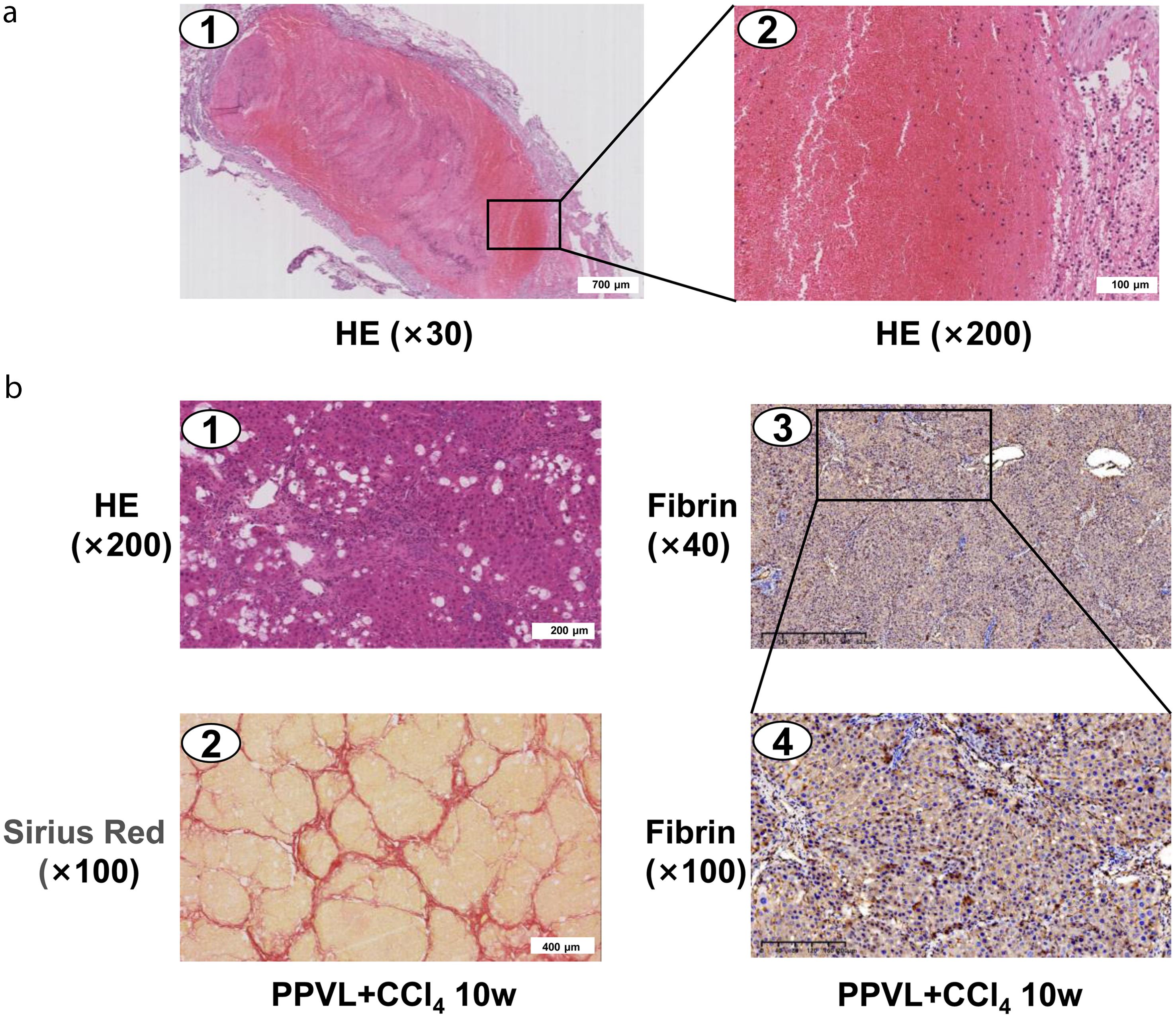 The characteristics of the cirrhotic portal vein thrombosis model in rats.