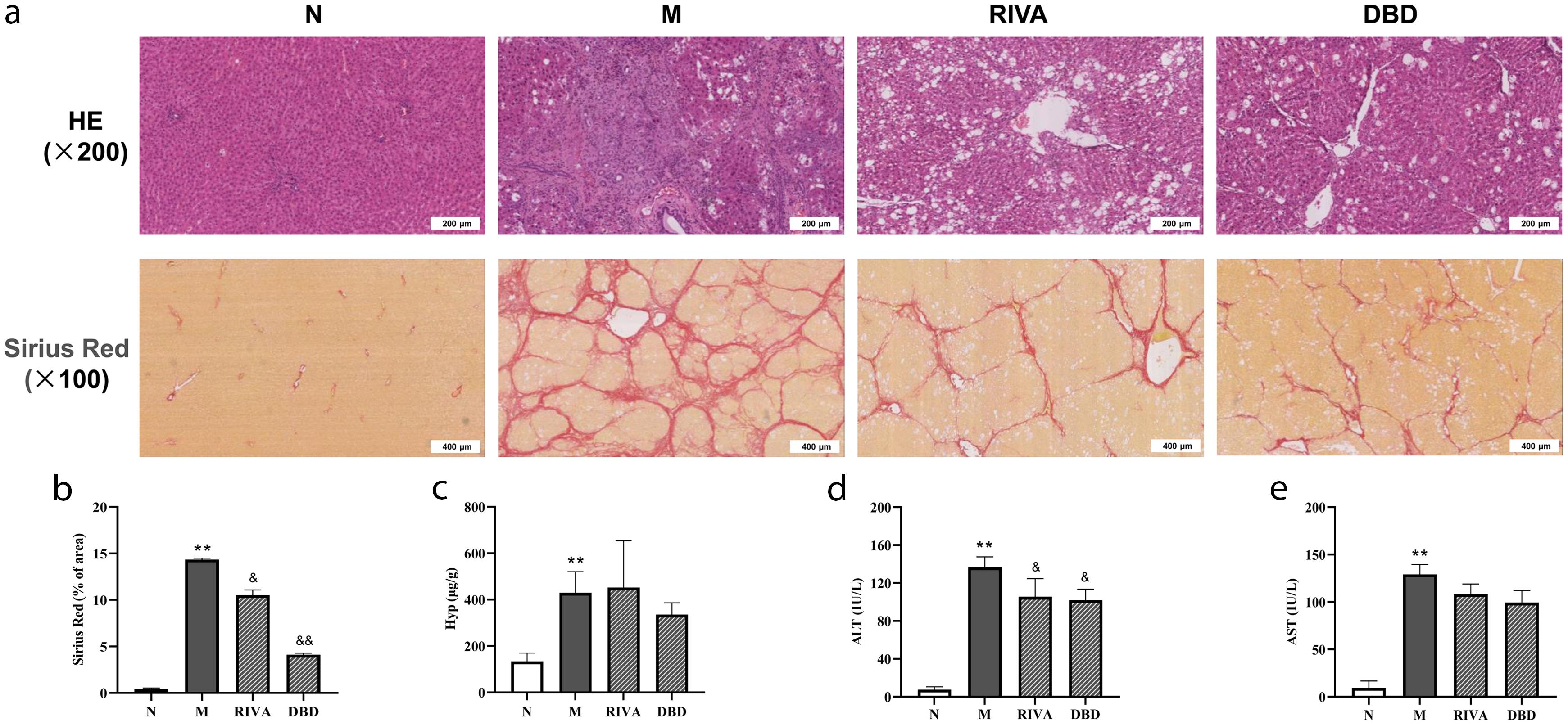 DBD attenuated liver fibrosis in model rats.