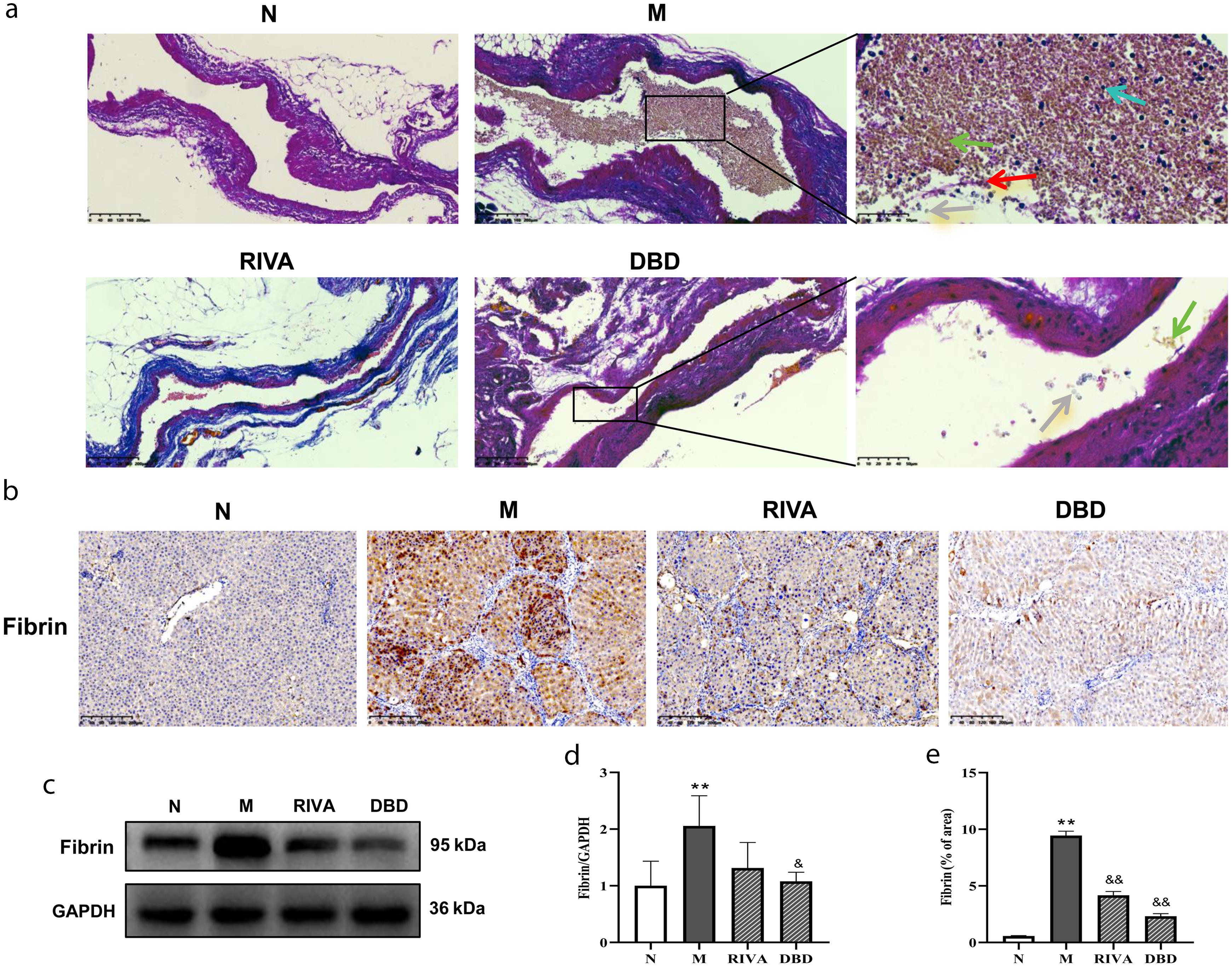 DBD reduced portal vein thrombosis and microthrombus deposition.