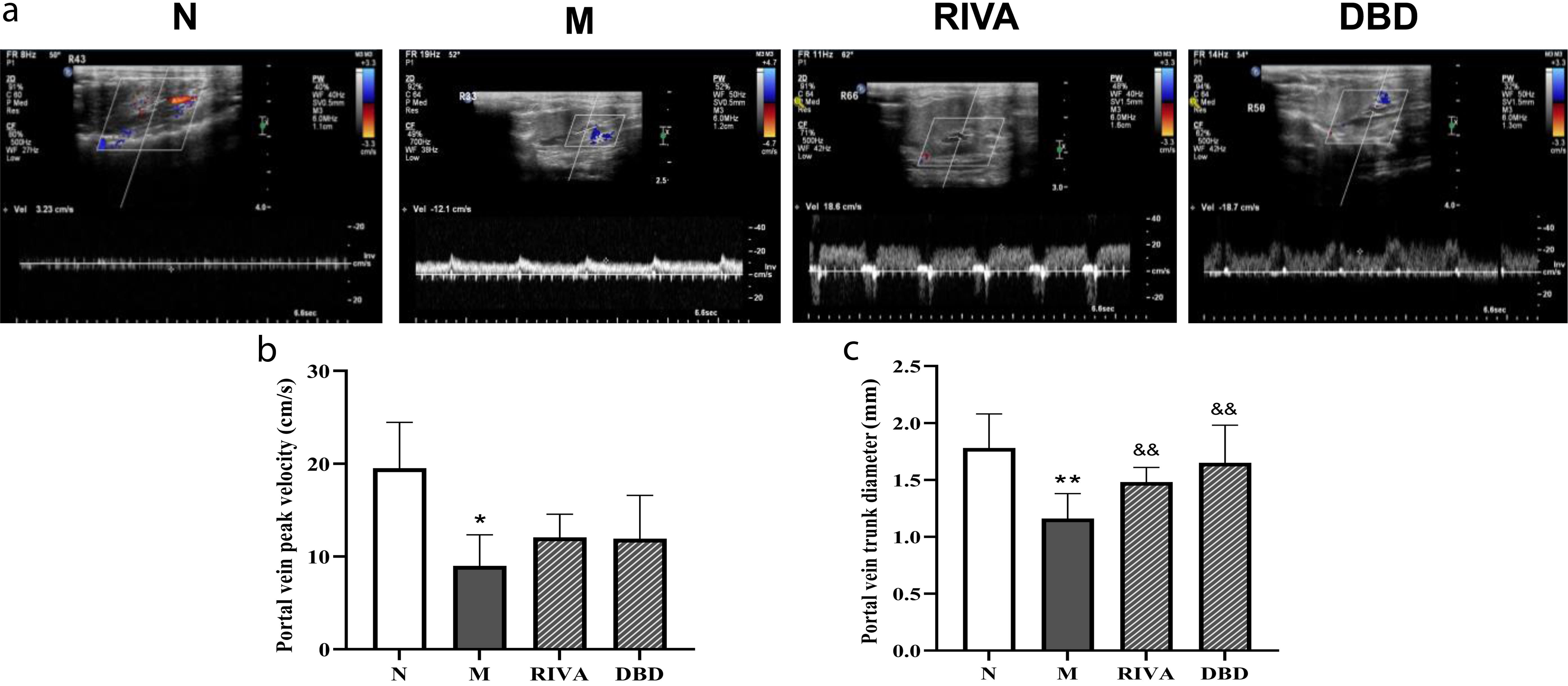 DBD widened the diameter of the portal vein and accelerated blood flow velocity in model rats.