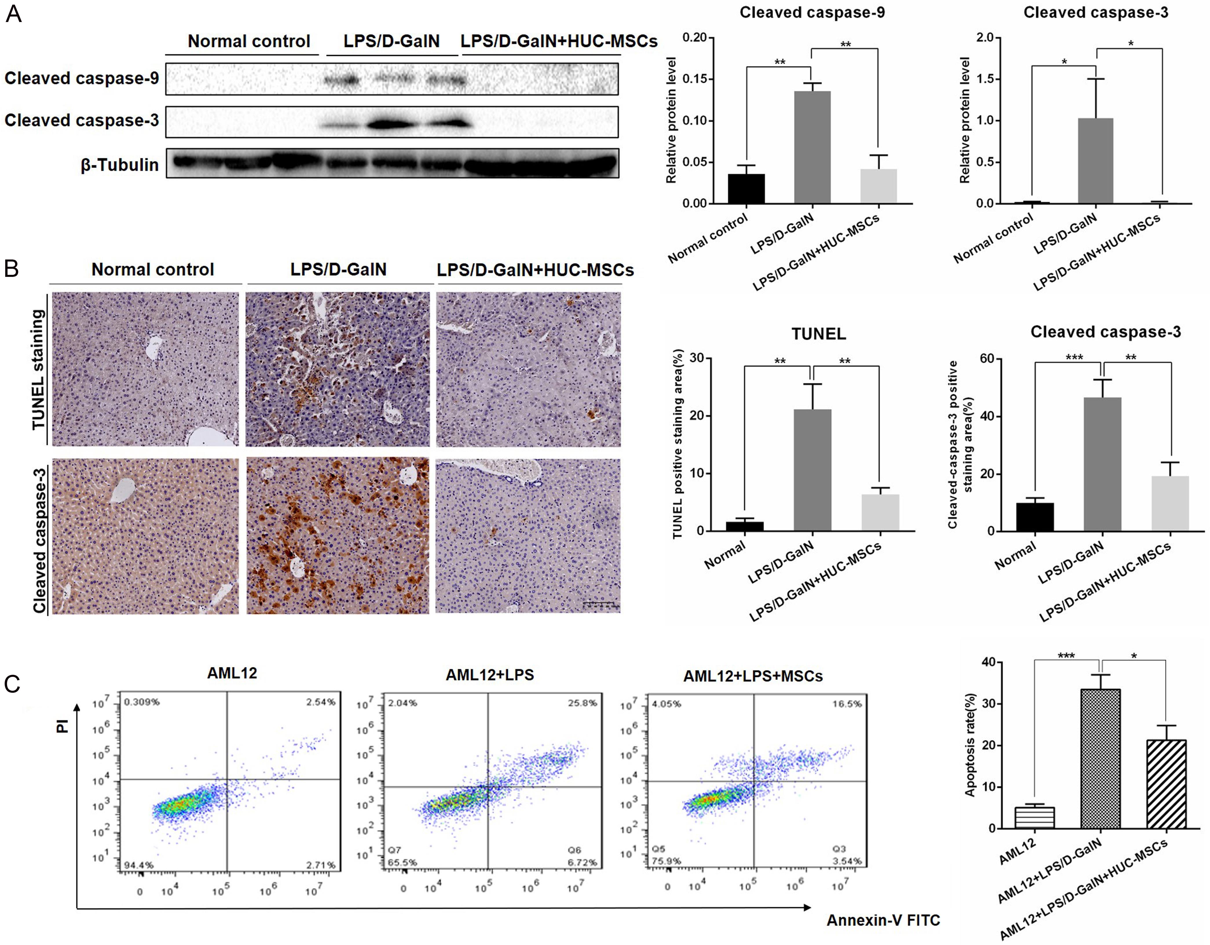 hUC-MSCs decreased hepatocyte apoptosis in the liver tissue and AML12 cells.