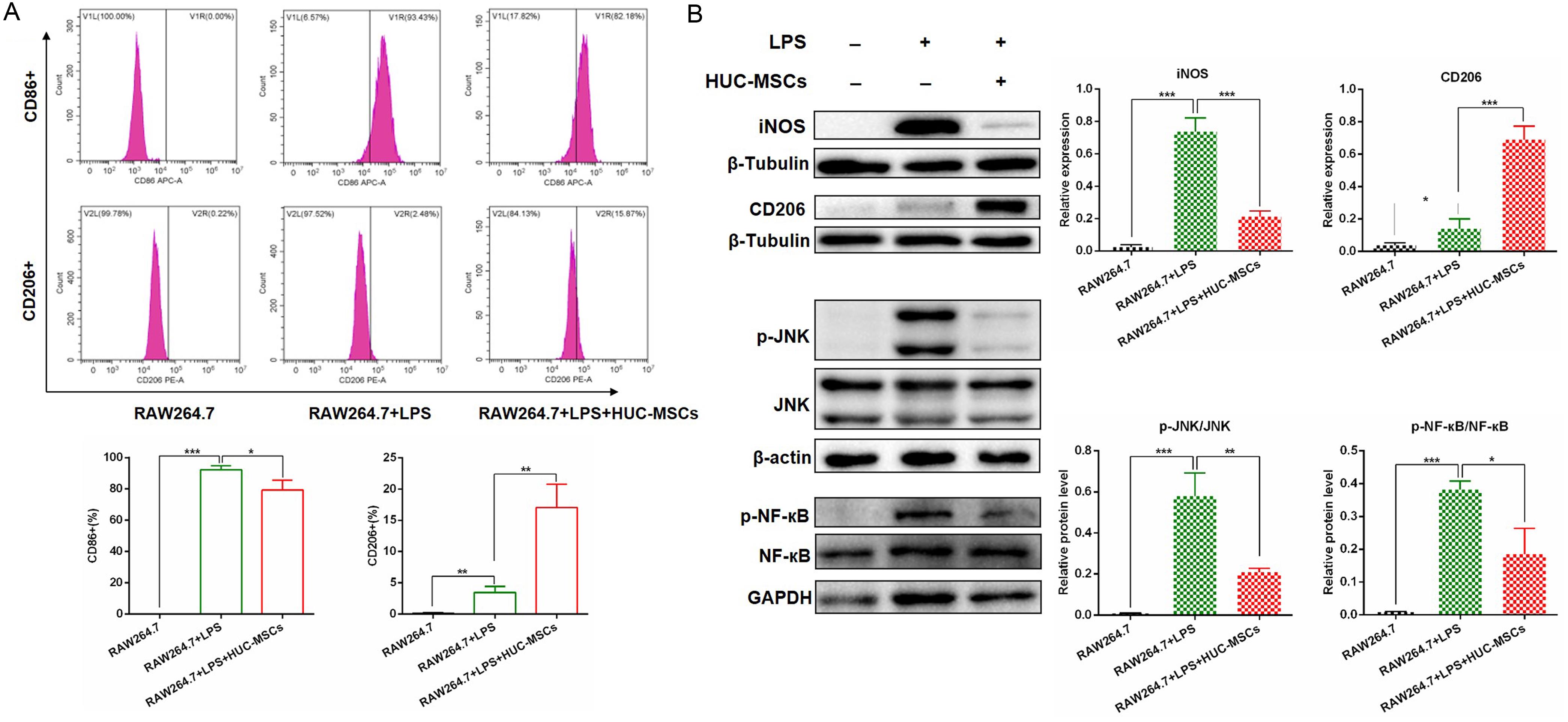 The hUC-MSCs co-culture regulated macrophage polarization through the JNK/NF-кB signaling pathway.