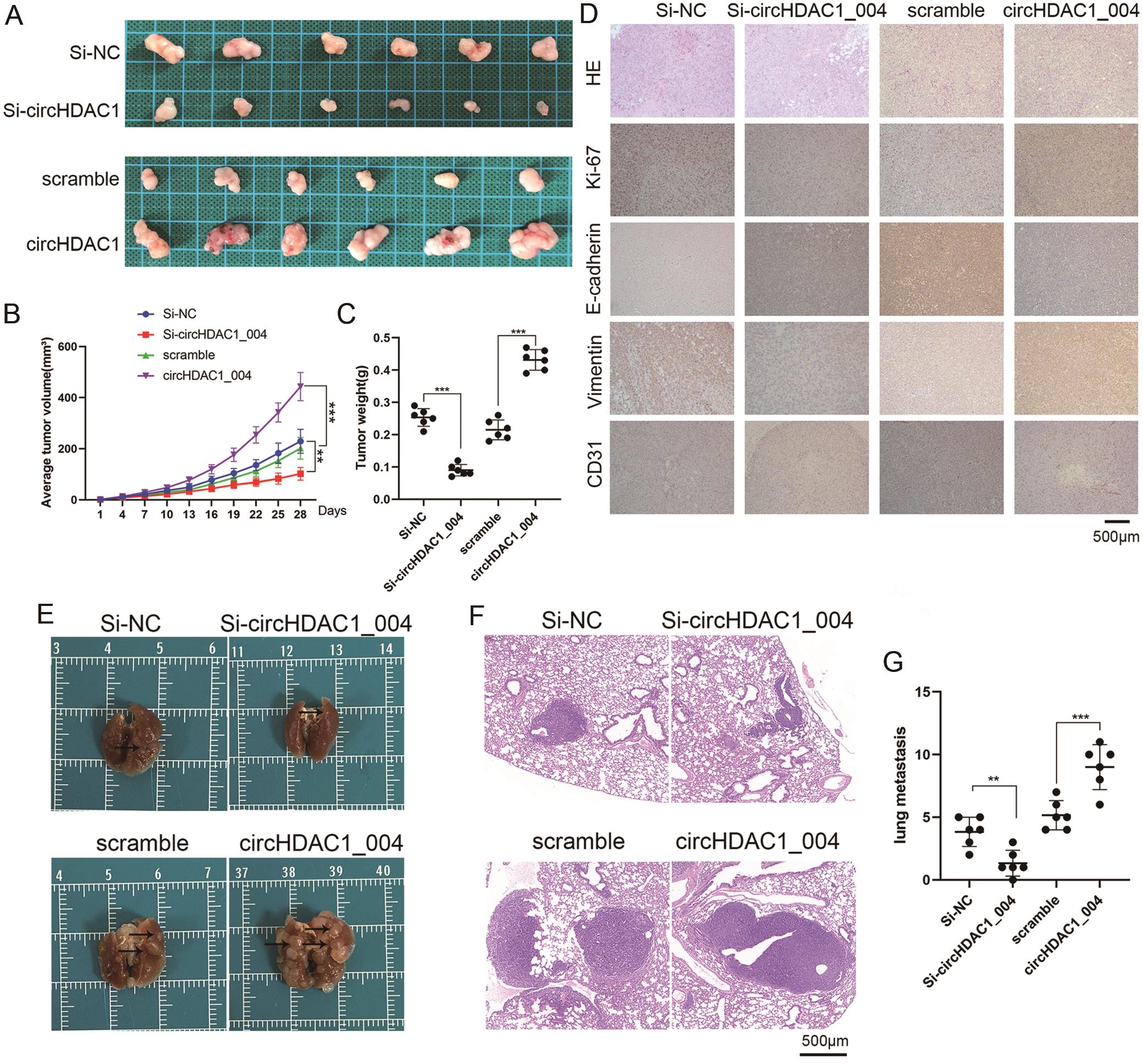 circHDAC1_004 facilitated the proliferation and metastasis of HCC cells <italic>in vivo</italic>.
