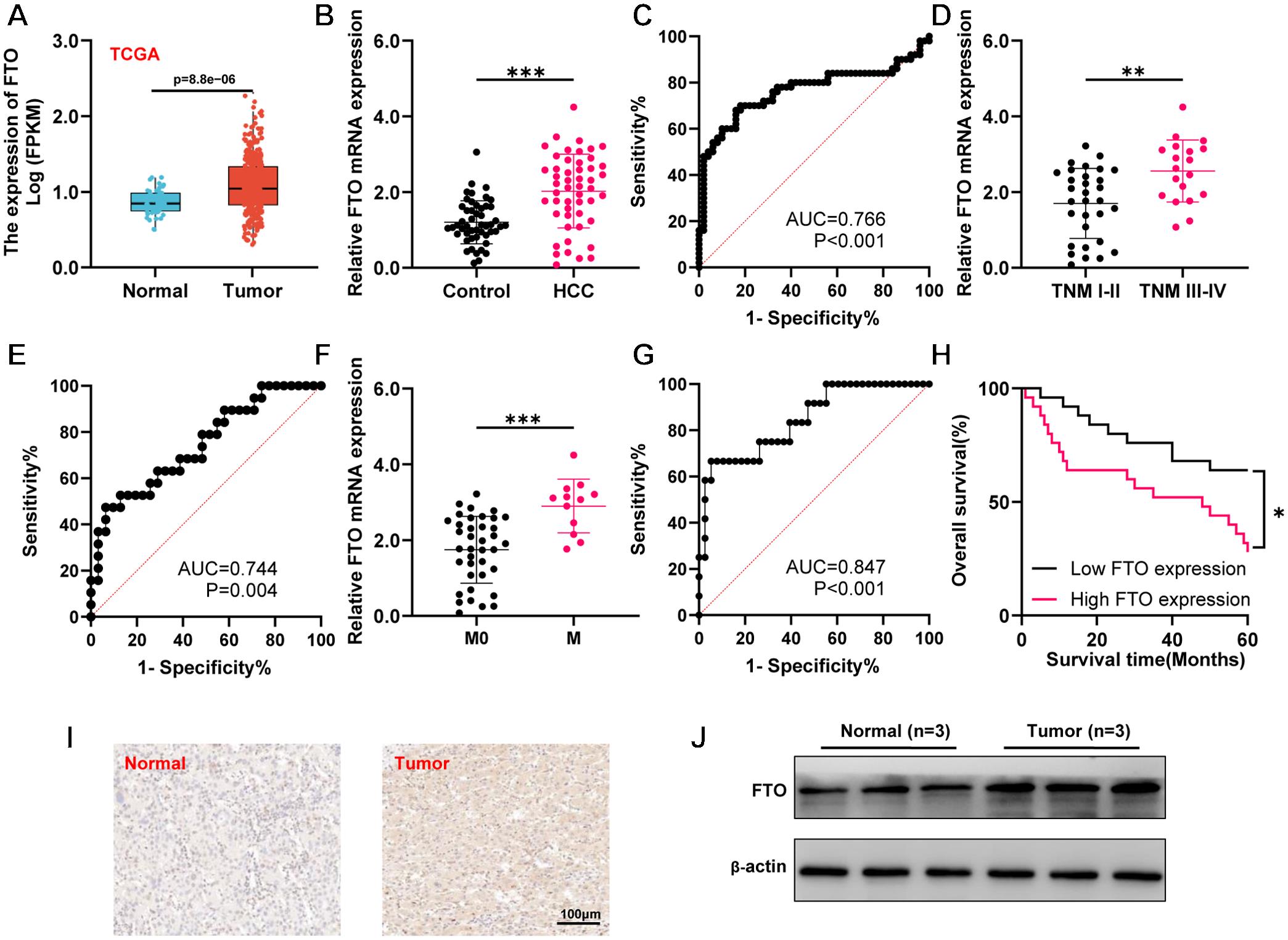 FTO expression in HCC and its relationship with clinical outcomes.