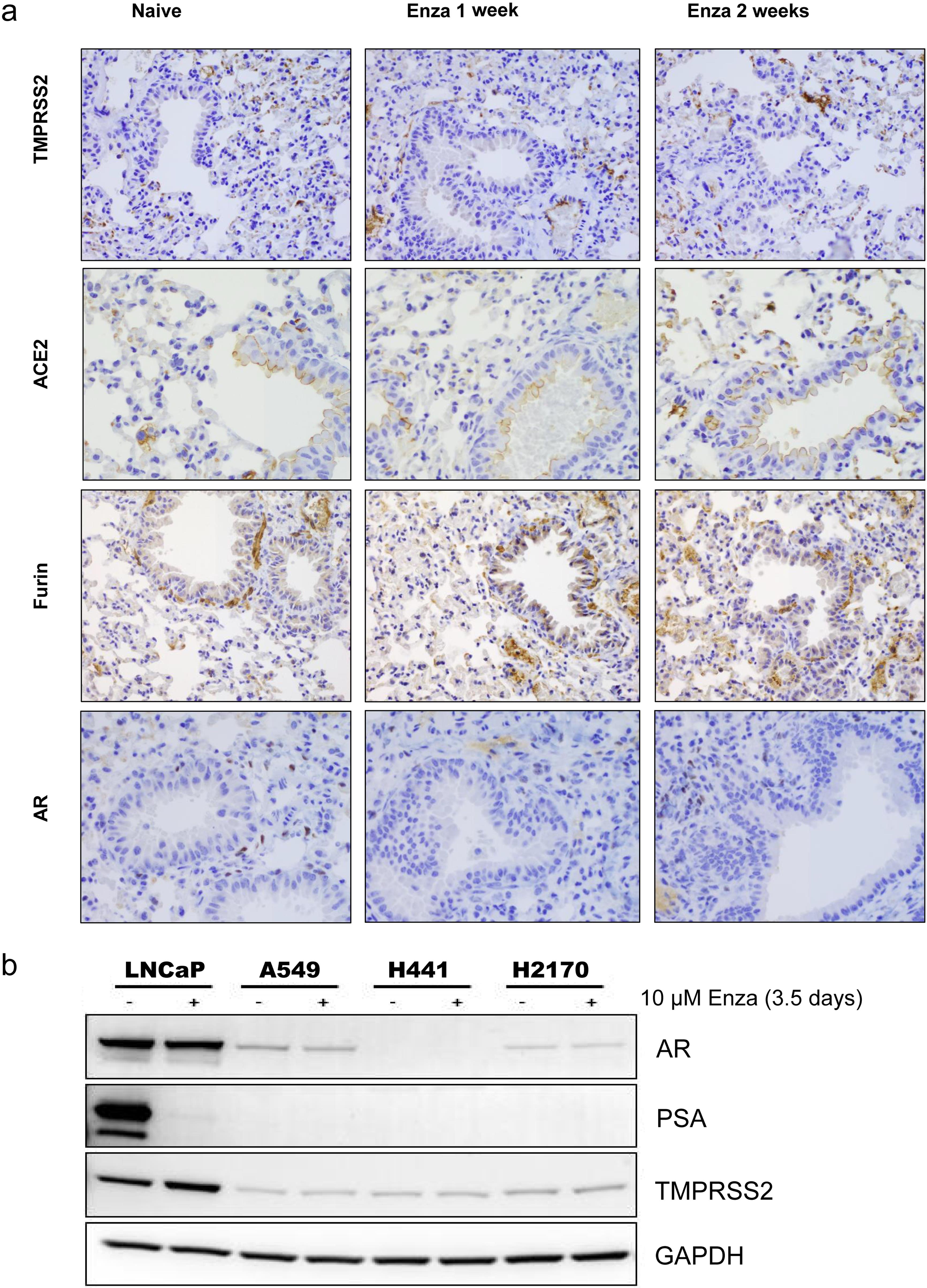 Androgen signaling showed no effect on regulating the expression of viral entry proteins in murine lungs.