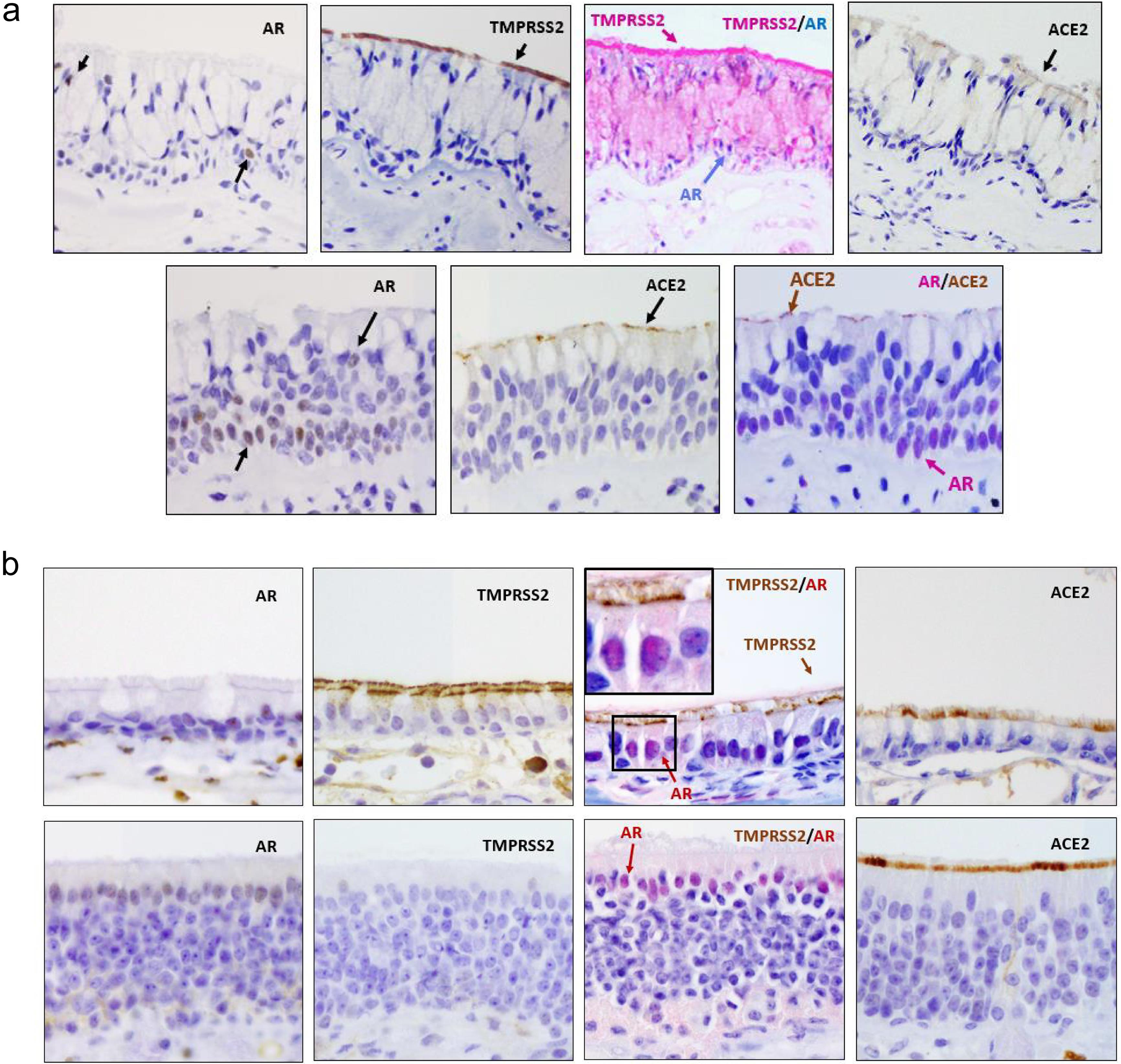 Co-expression of AR and viral entry proteins in the human and murine sinonasal epithelium.