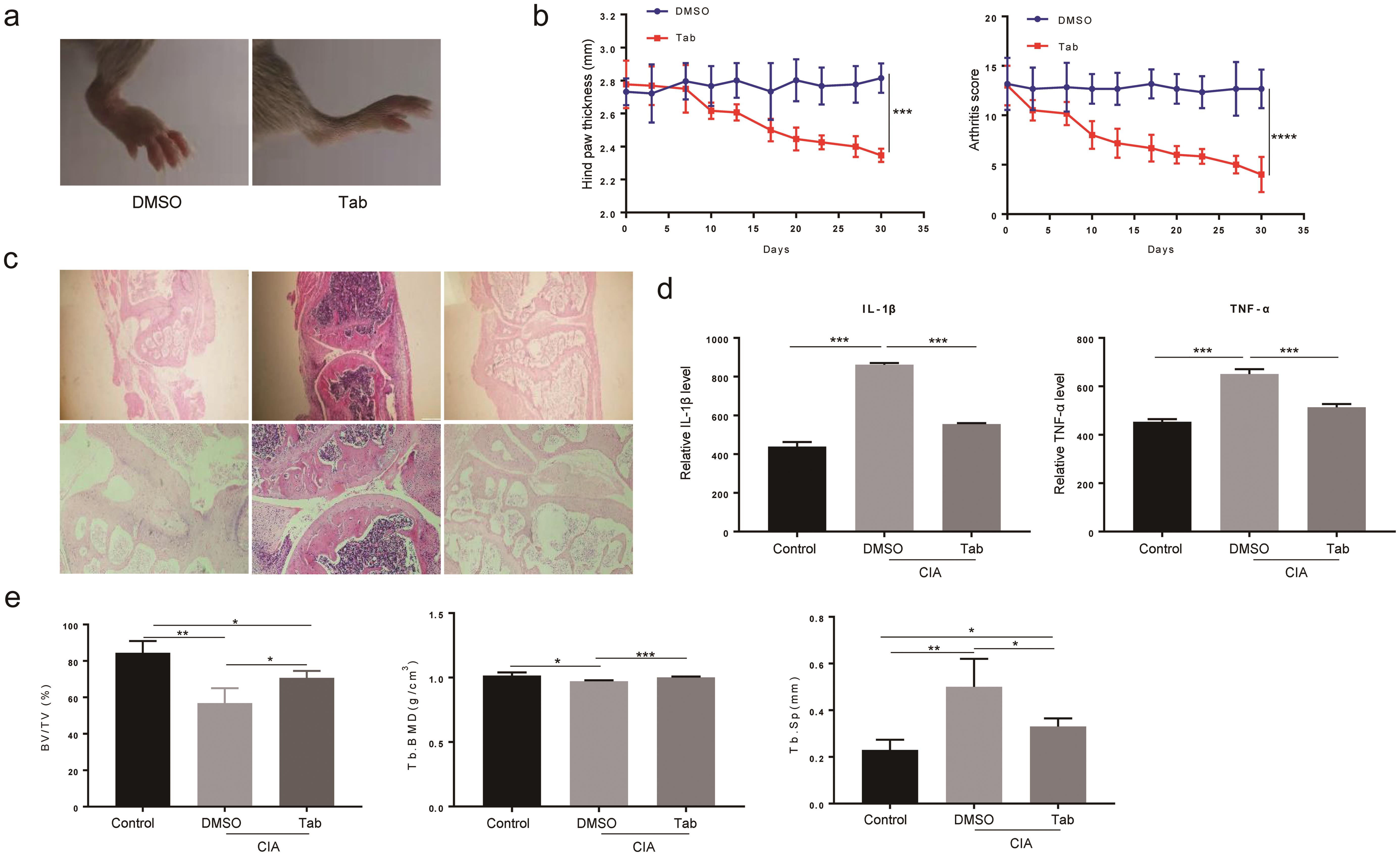 The effects of Tab on the disease progression in CIA mice.