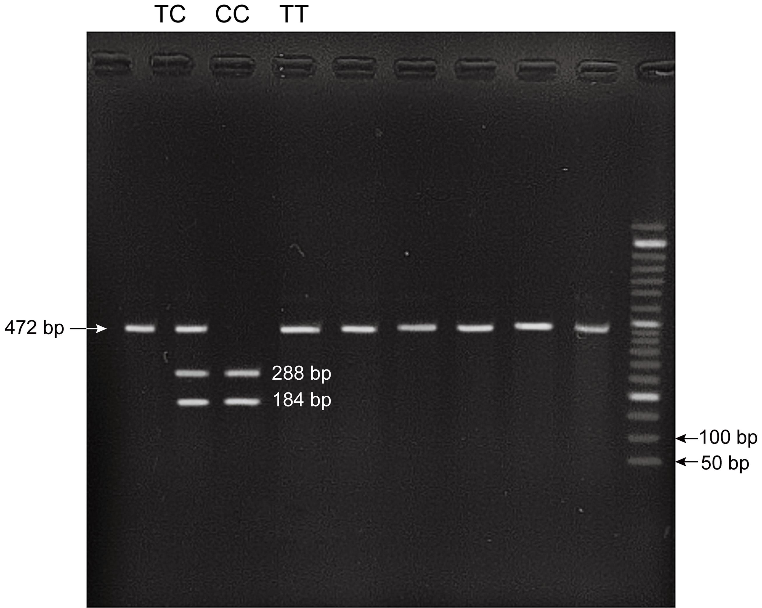 IL-27p28 (rs181206T>C) PCR product after digestion with fauI enzyme.