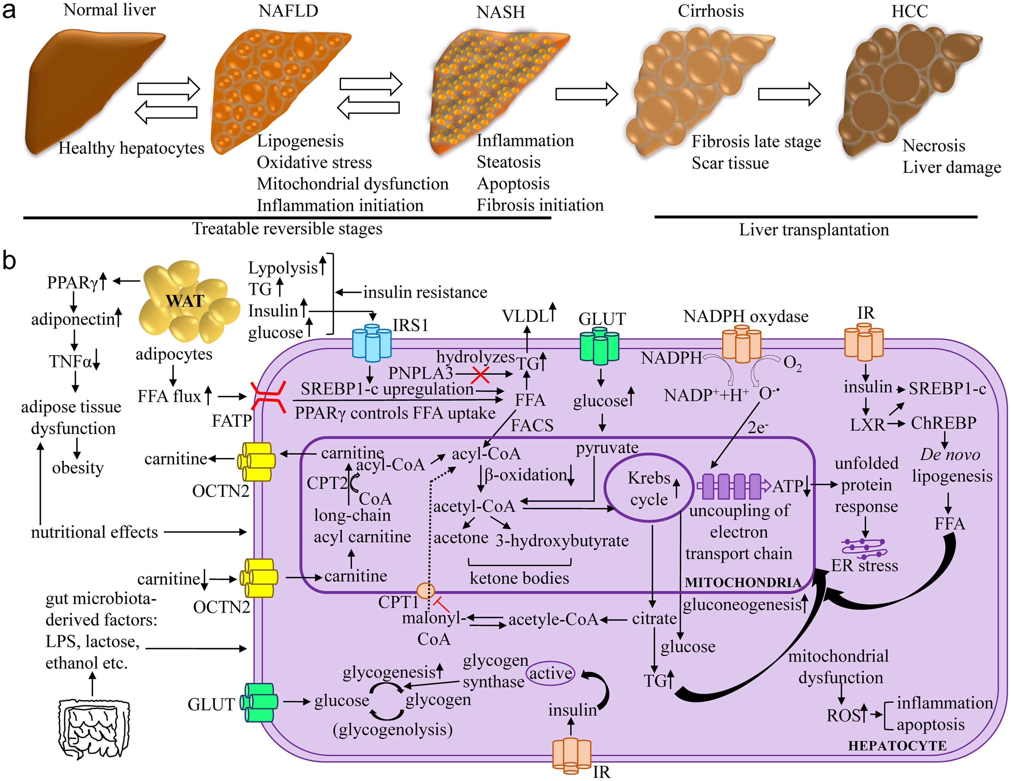 Different stages of pathophysiological conditions, starting from NAFLD to HCC, can be characterized based on the biological and molecular aspect (Panel A). The molecular understanding of multifactorial NAFLD pathogenesis (panel B).