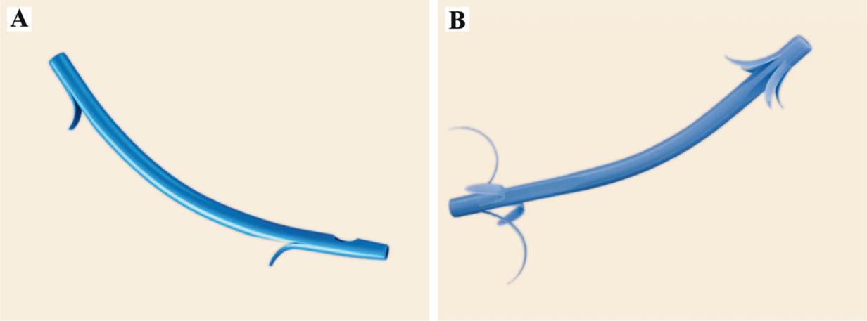 Plastic stents (Granted permission for use).