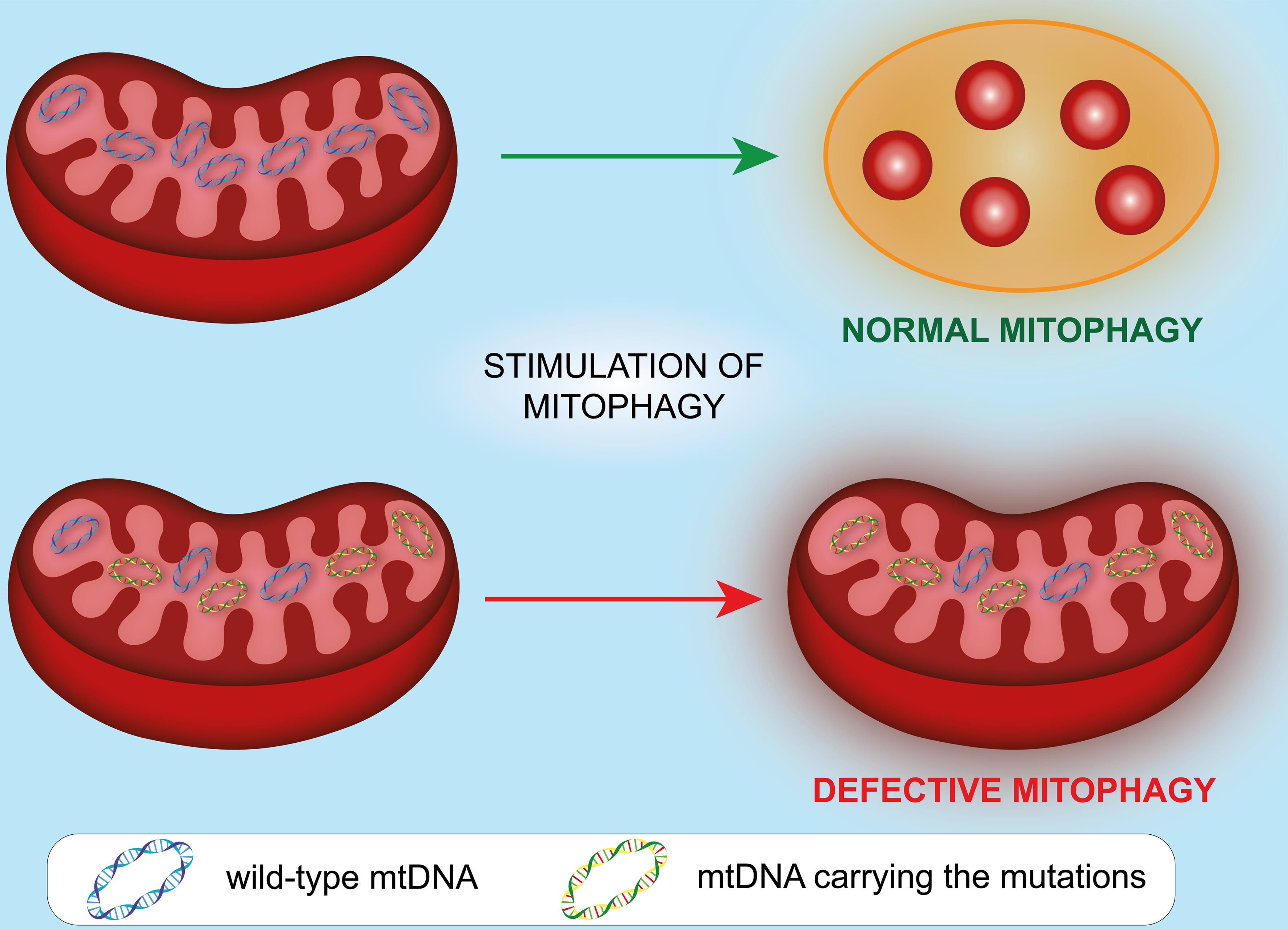 Hypothetical causal role of mutations in mitochondrial DNA in developing defective mitophagy that induces an excessive and continuous inflammatory response.