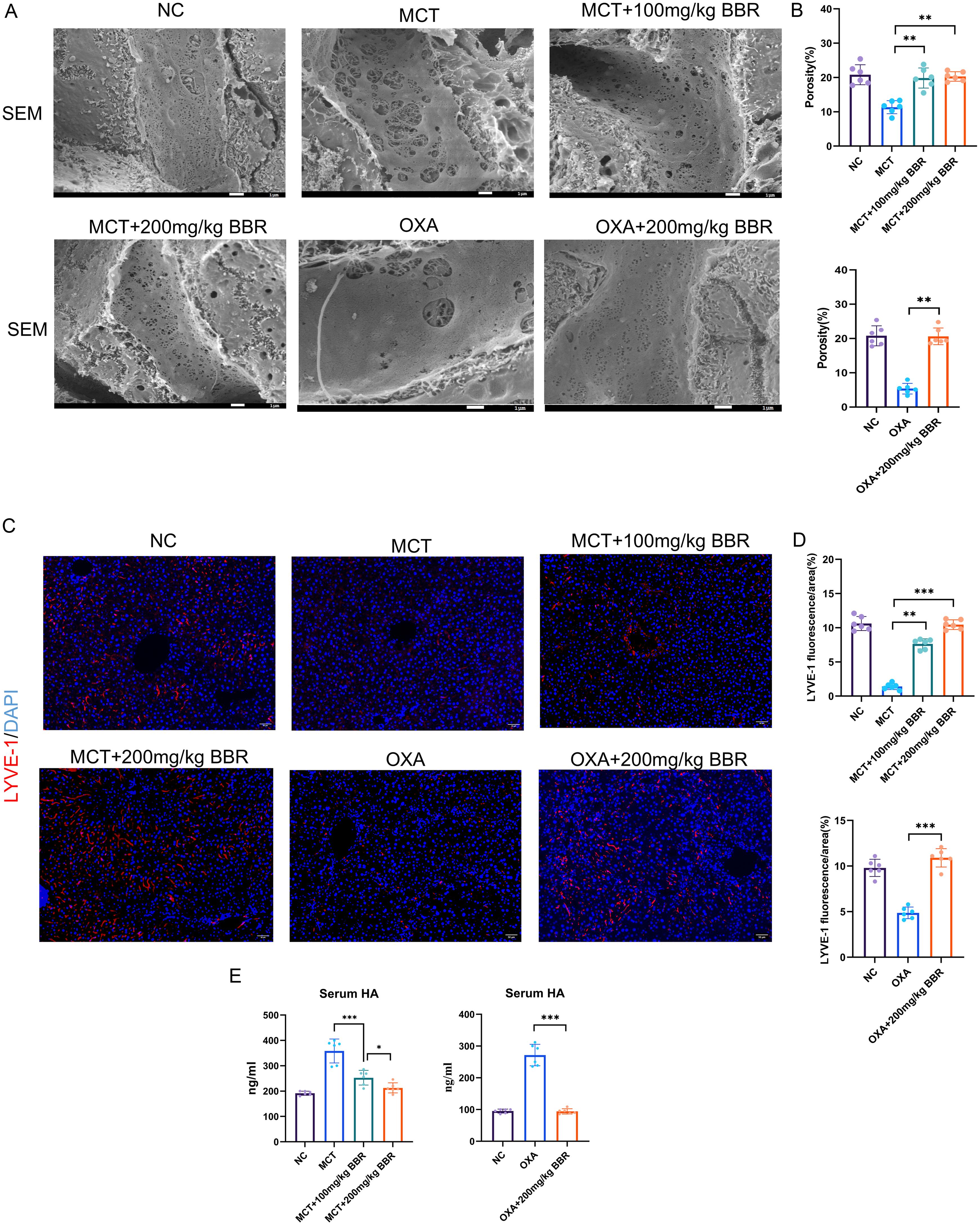 The effects of BBR on LSECs in mice with HSOS.