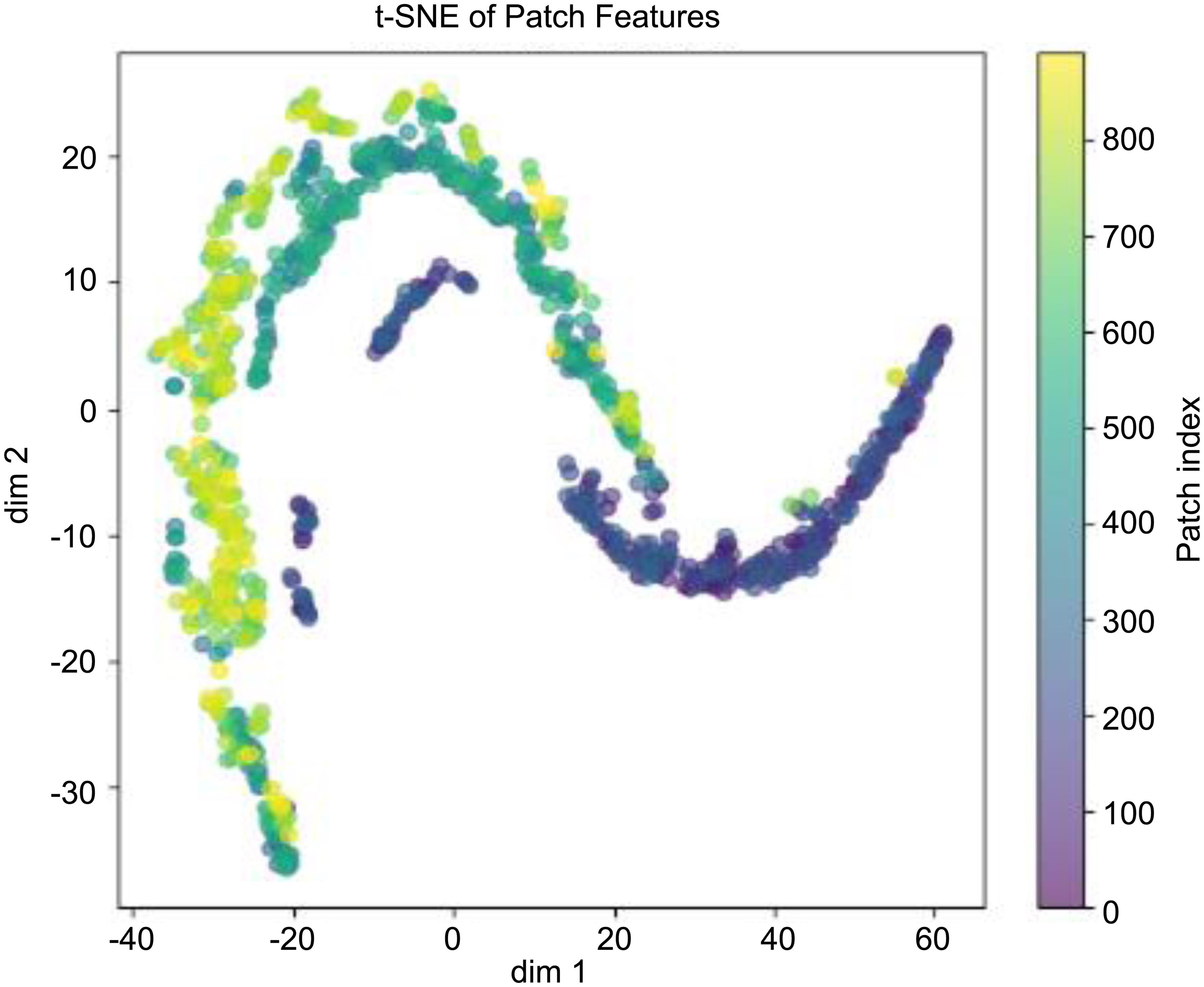 t-Distributed Stochastic Neighbor Embedding (t-SNE) embedding of 512×512 px Whole Slide Image (WSI) patches from precancerous and malignant rectal lesions.