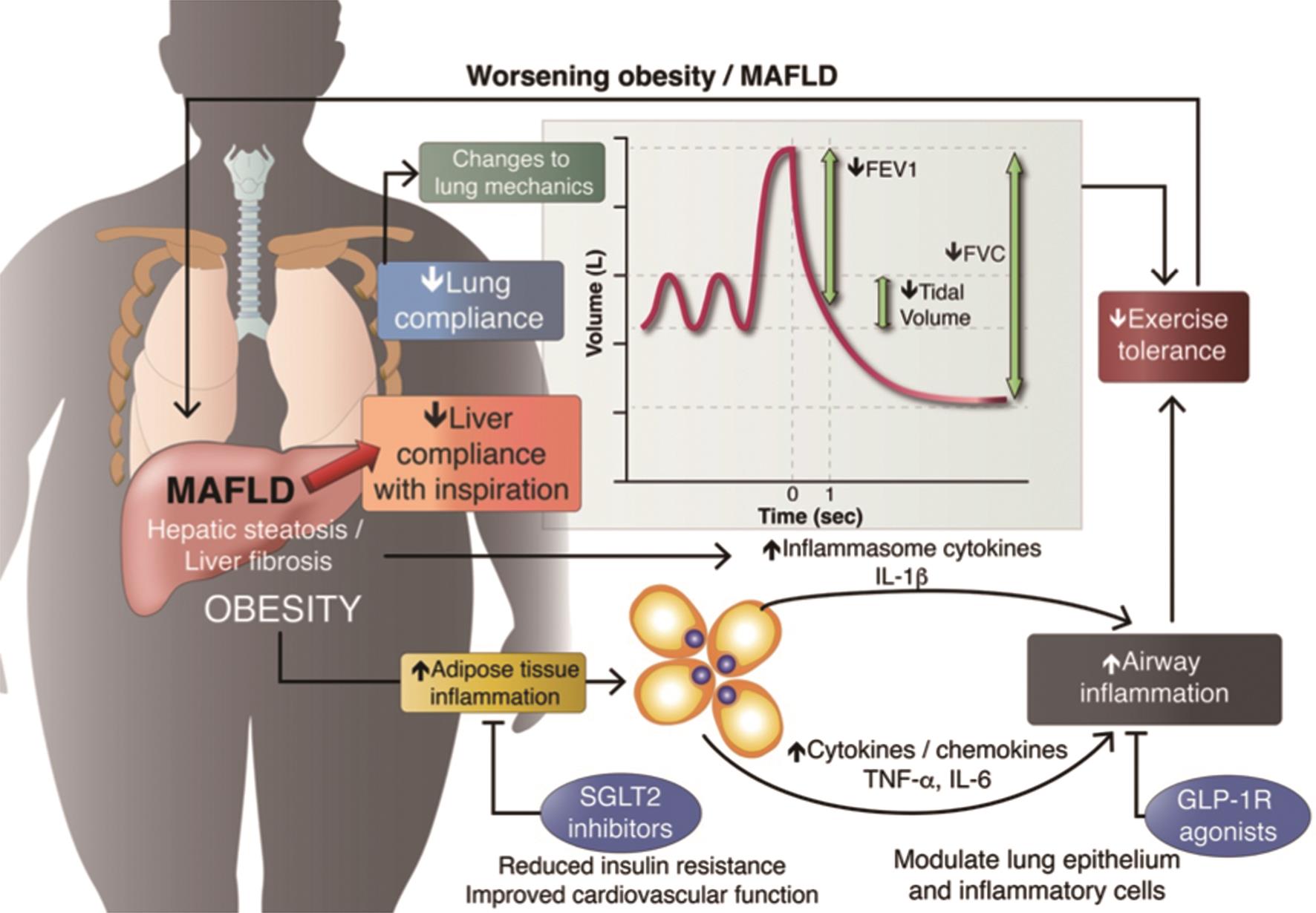 Effects of metabolic-associated liver disease (MAFLD), obesity, and liver fibrosis on respiratory function and current therapeutic options.