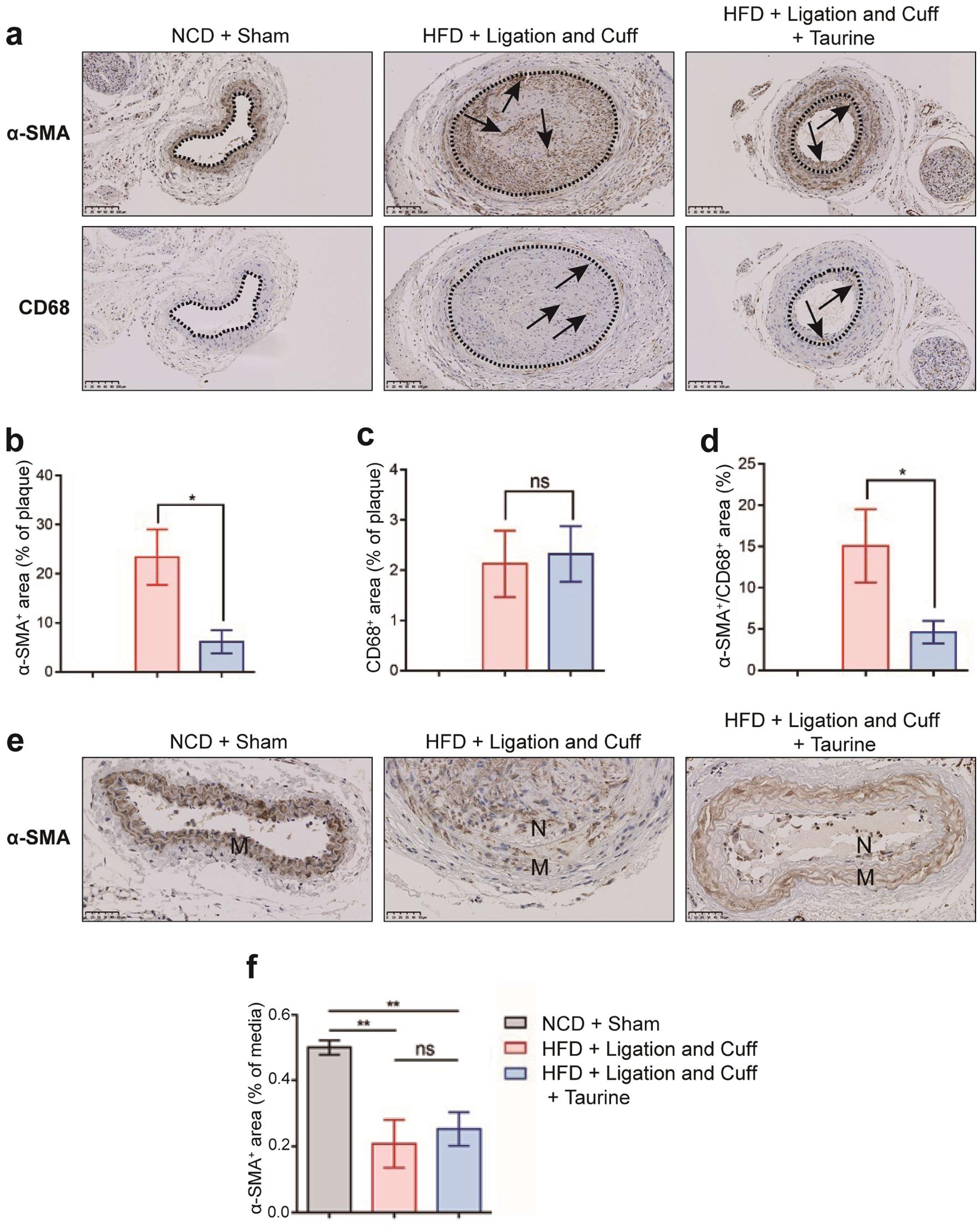 Effects of taurine on smooth muscle cells and macrophages in the carotid arteries of atherosclerotic mice (n = 6).