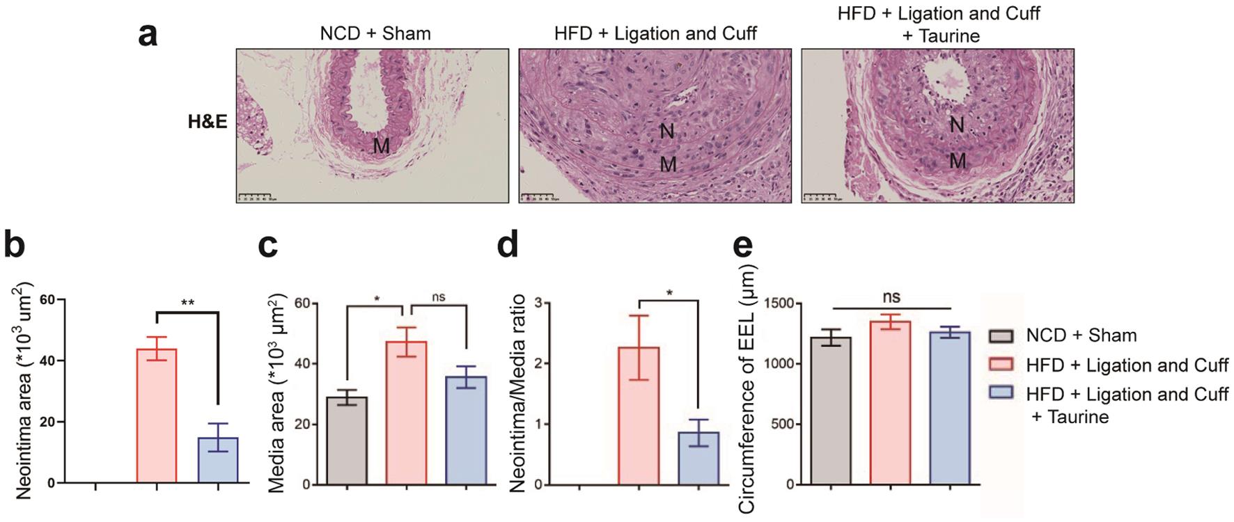 Effects of taurine on carotid intima-media ratio and outer circumference in mice (n = 6).