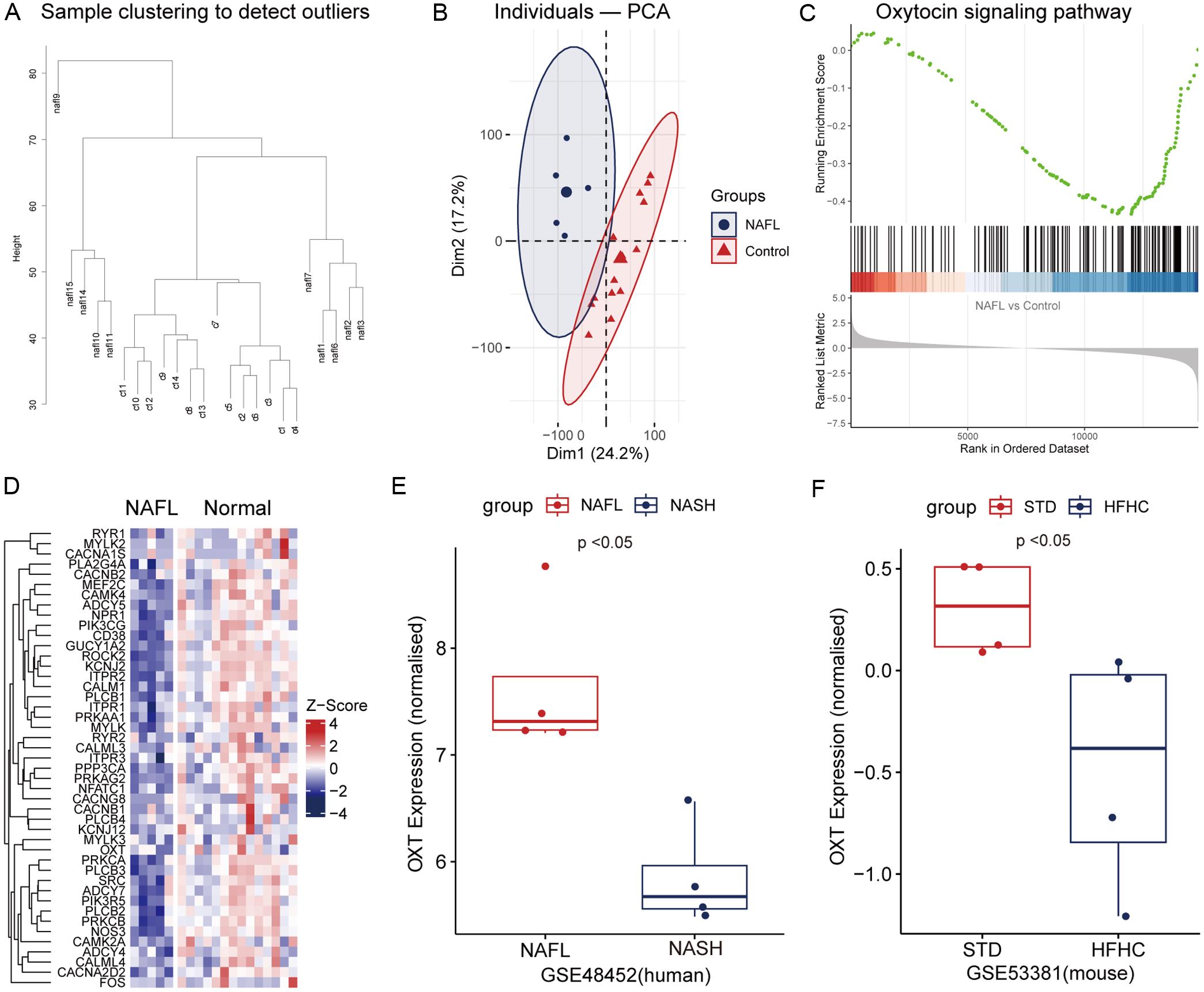 Bioinformatics analysis of OXT expression levels in MASLD.