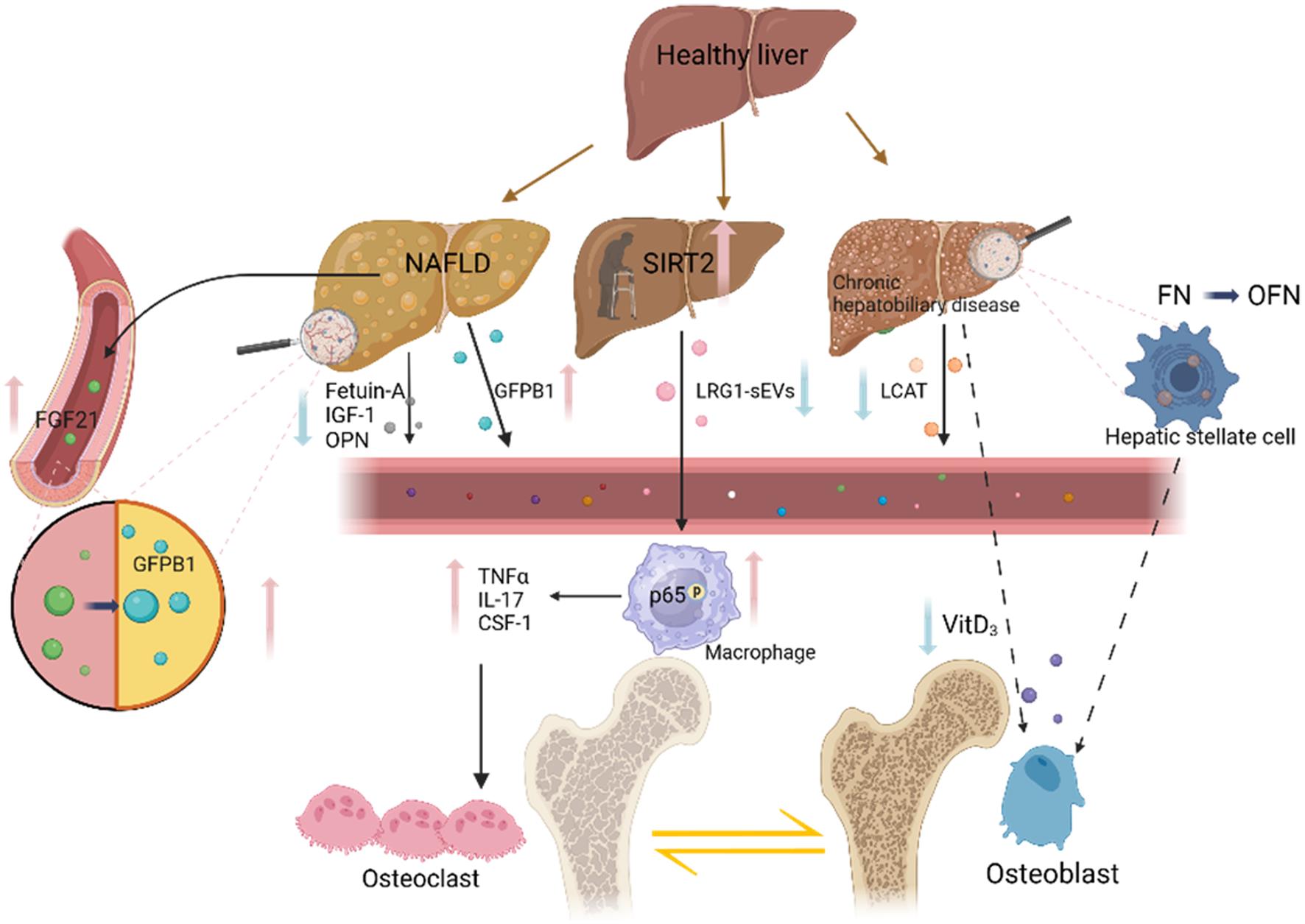 Factors affecting bone turnover in patients with liver disease.