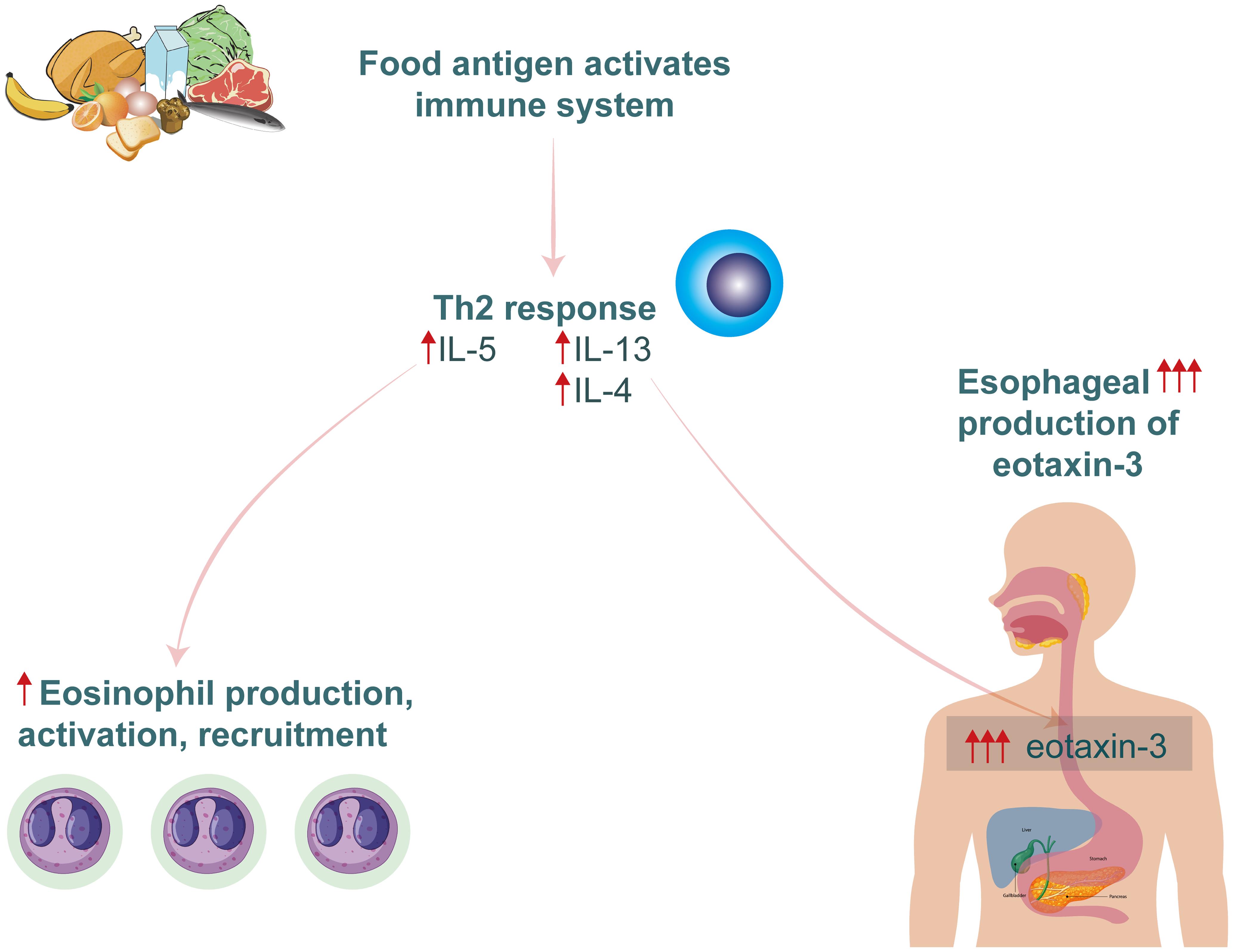 Th2 and eotaxin mechanisms in EoE.