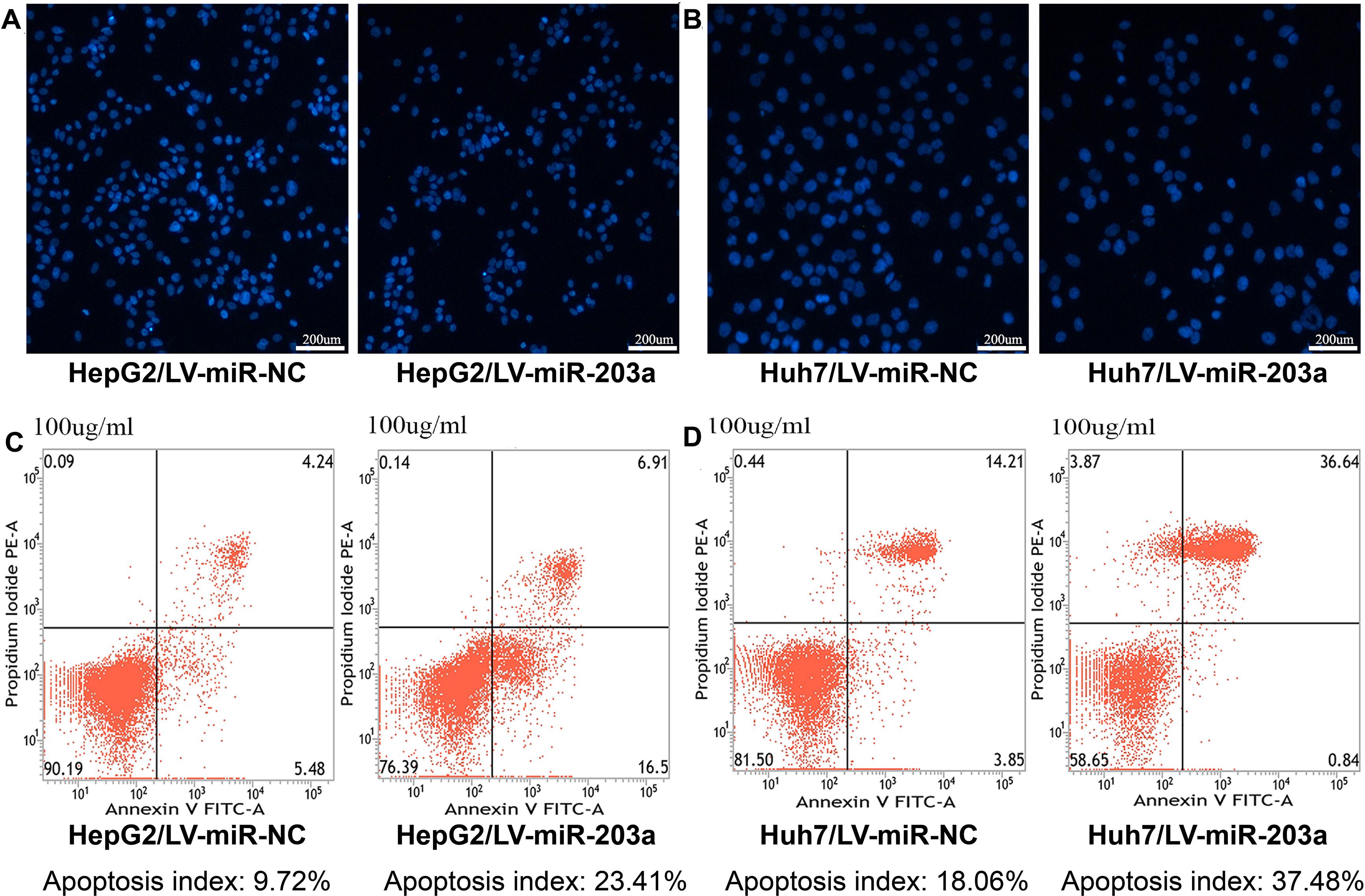 5-FU-induced apoptosis in HCC cells is influenced by miR-203a.