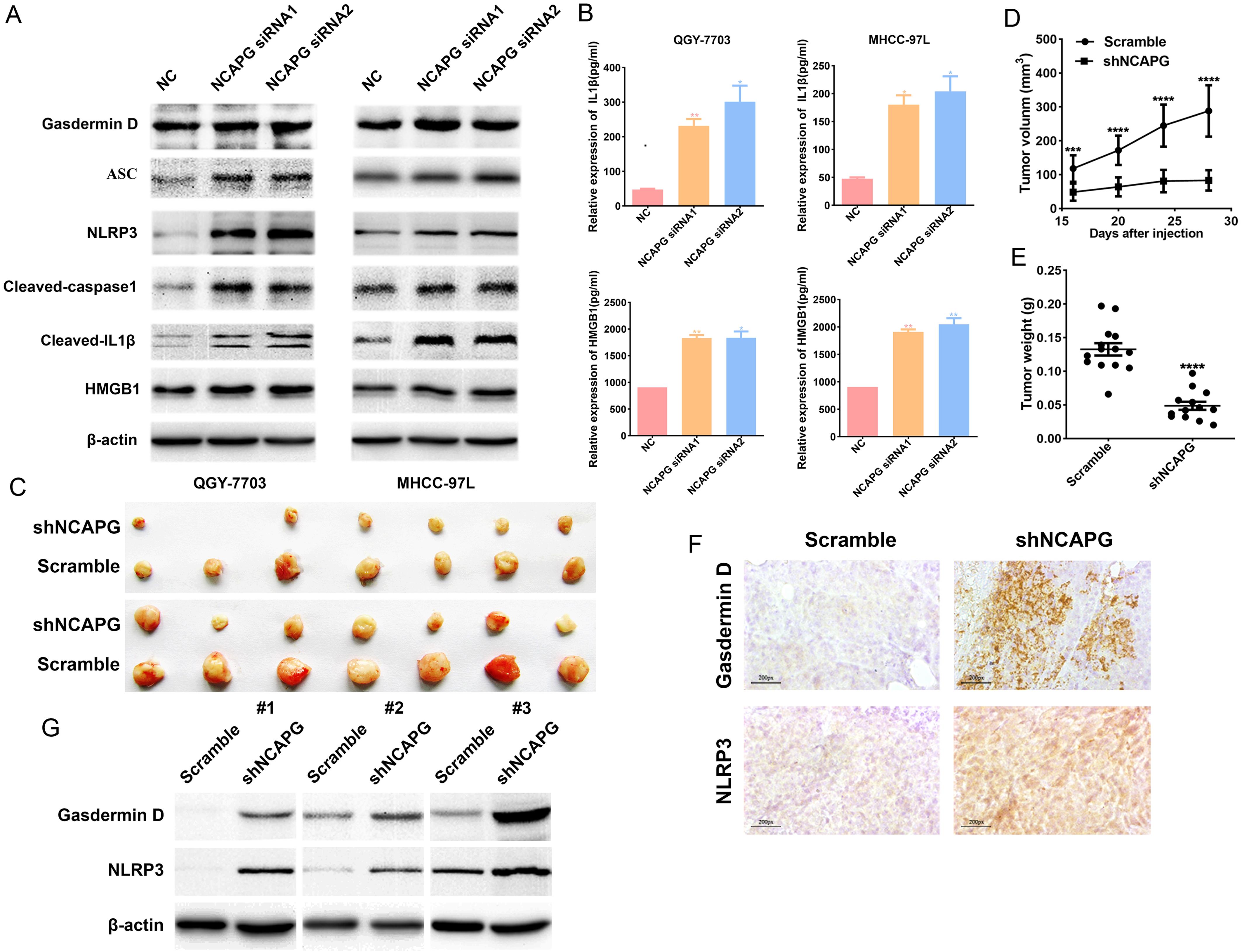 NCAPG regulated the NLRP3 inflammasome-mediated pyroptosis.