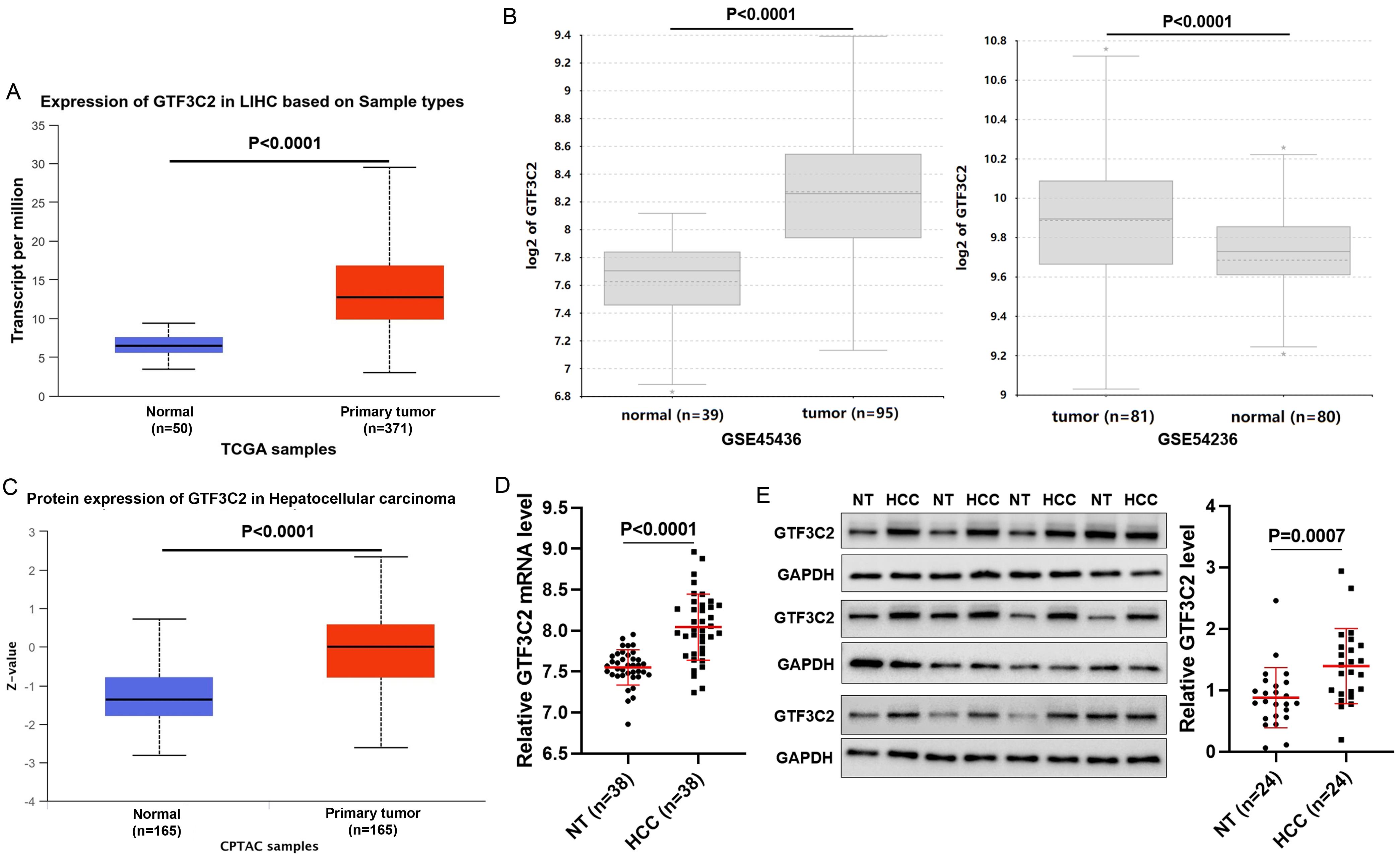 The expression of GTF3C2 in HCC.