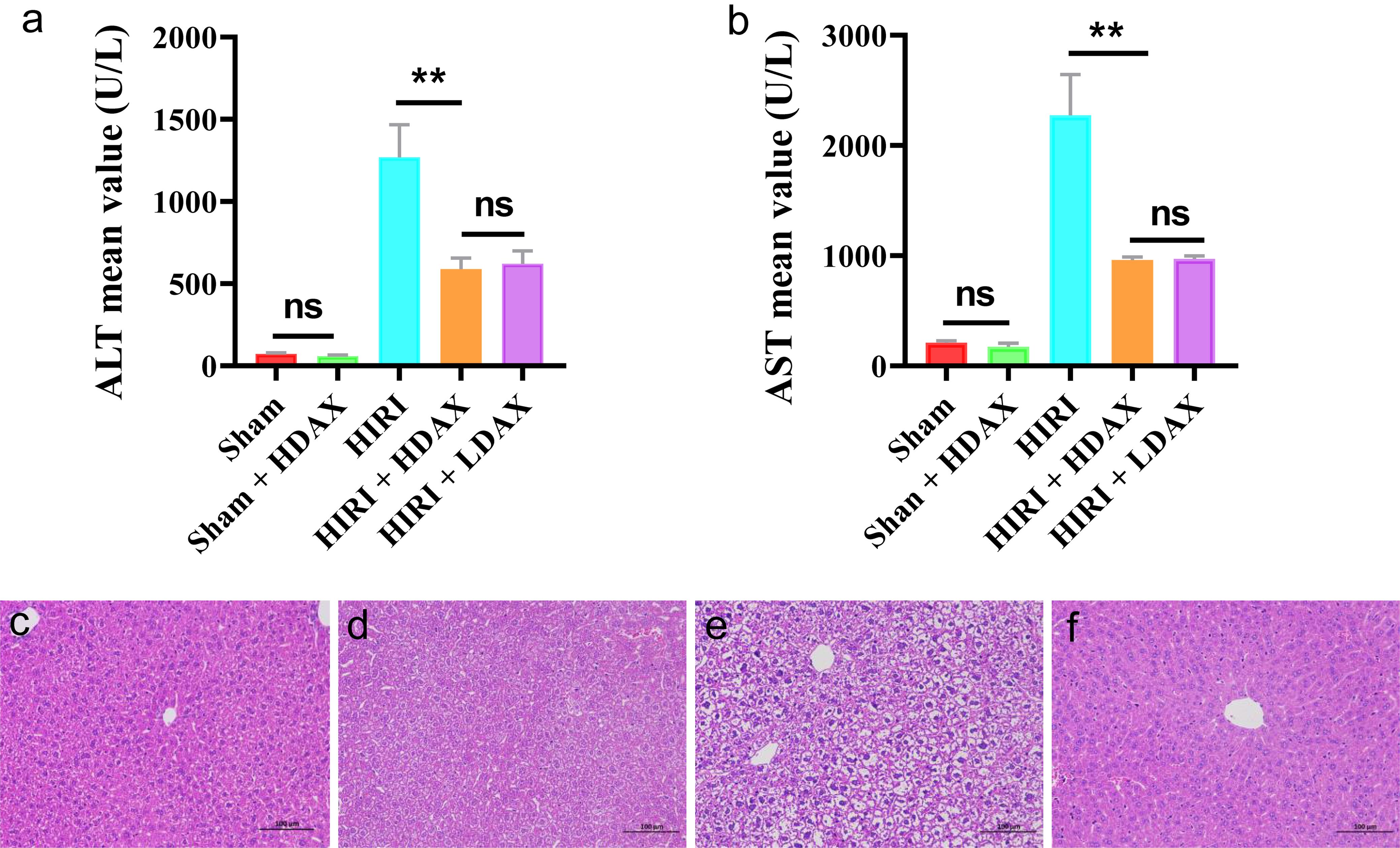 Biochemical and HE test results.