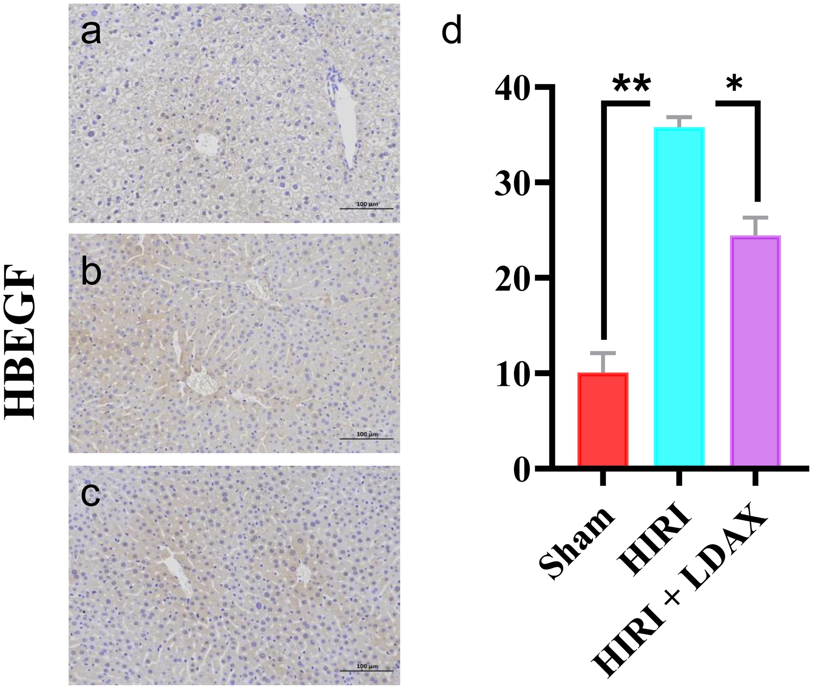 HBEGF was verified by immunohistochemical.