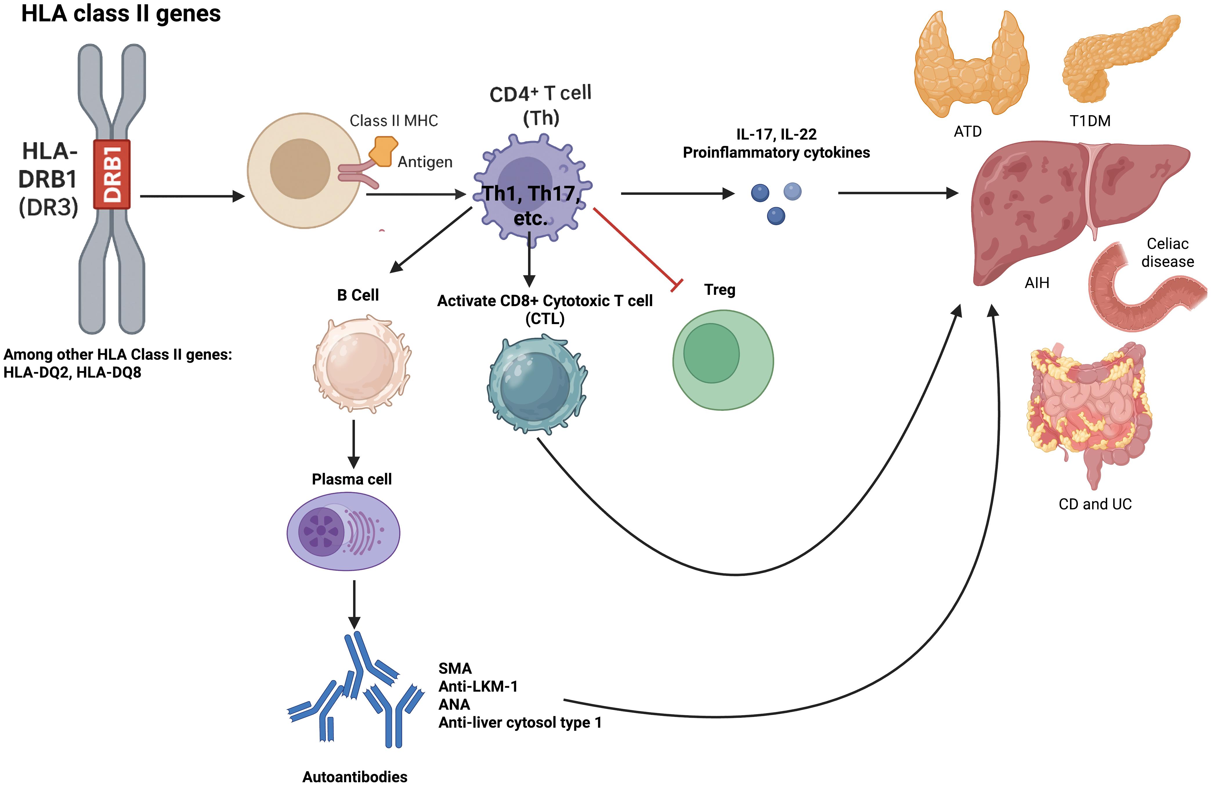 A diagram showing possible pathogenetic pathways of AIH and associated autoimmune diseases.
