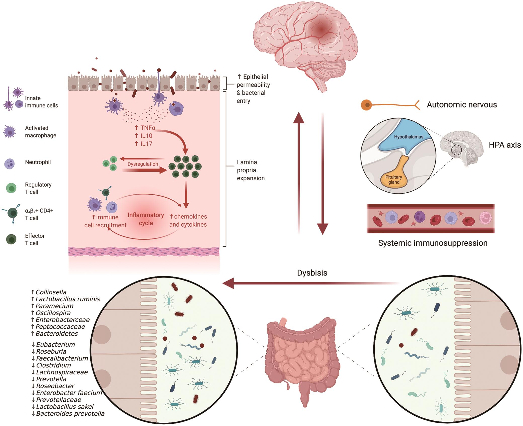 The interaction between gut microbiota and ischemic stroke.