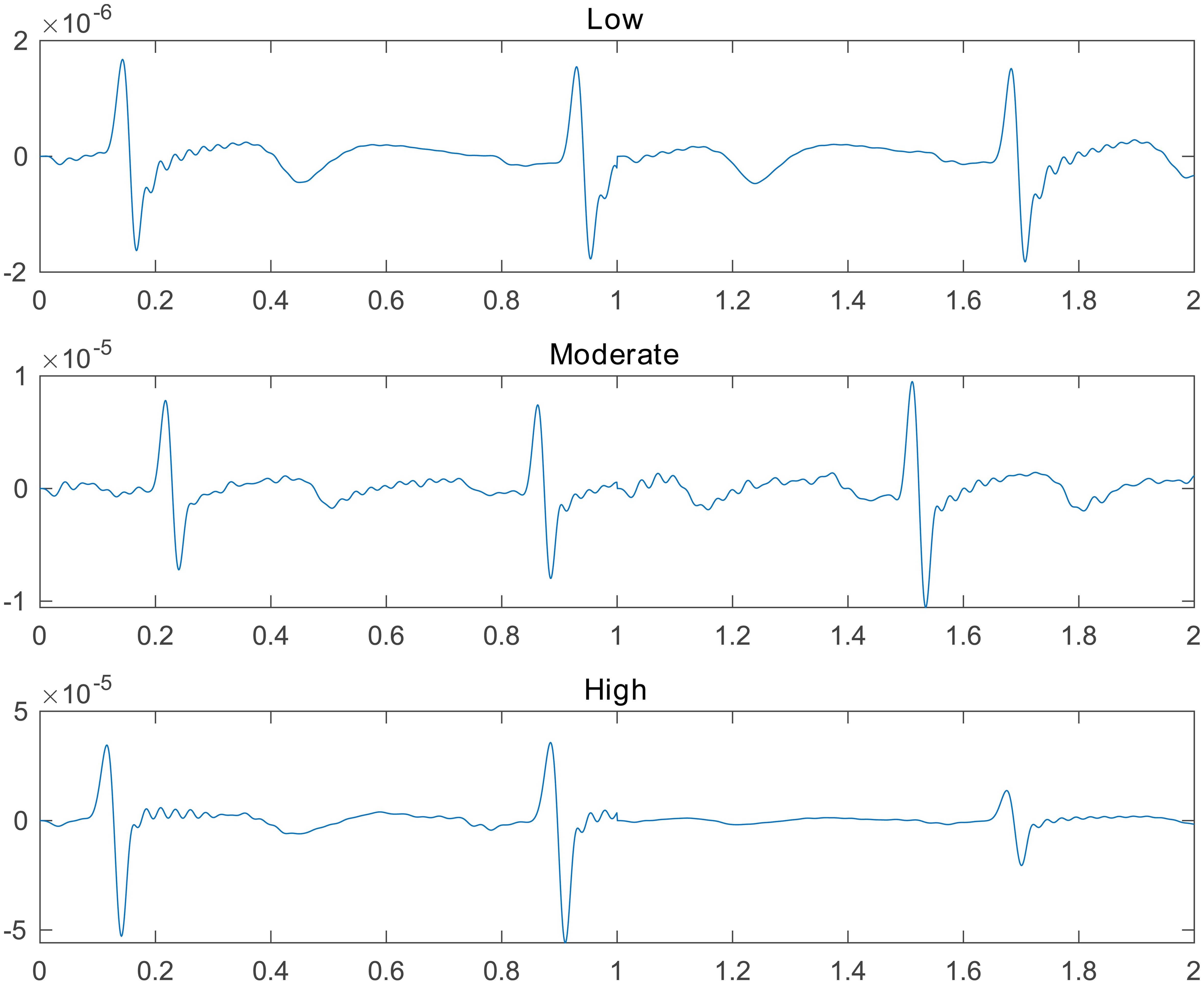 2-second electrocardiogram signal example of each cardiovascular risk class after normalization and filtering.