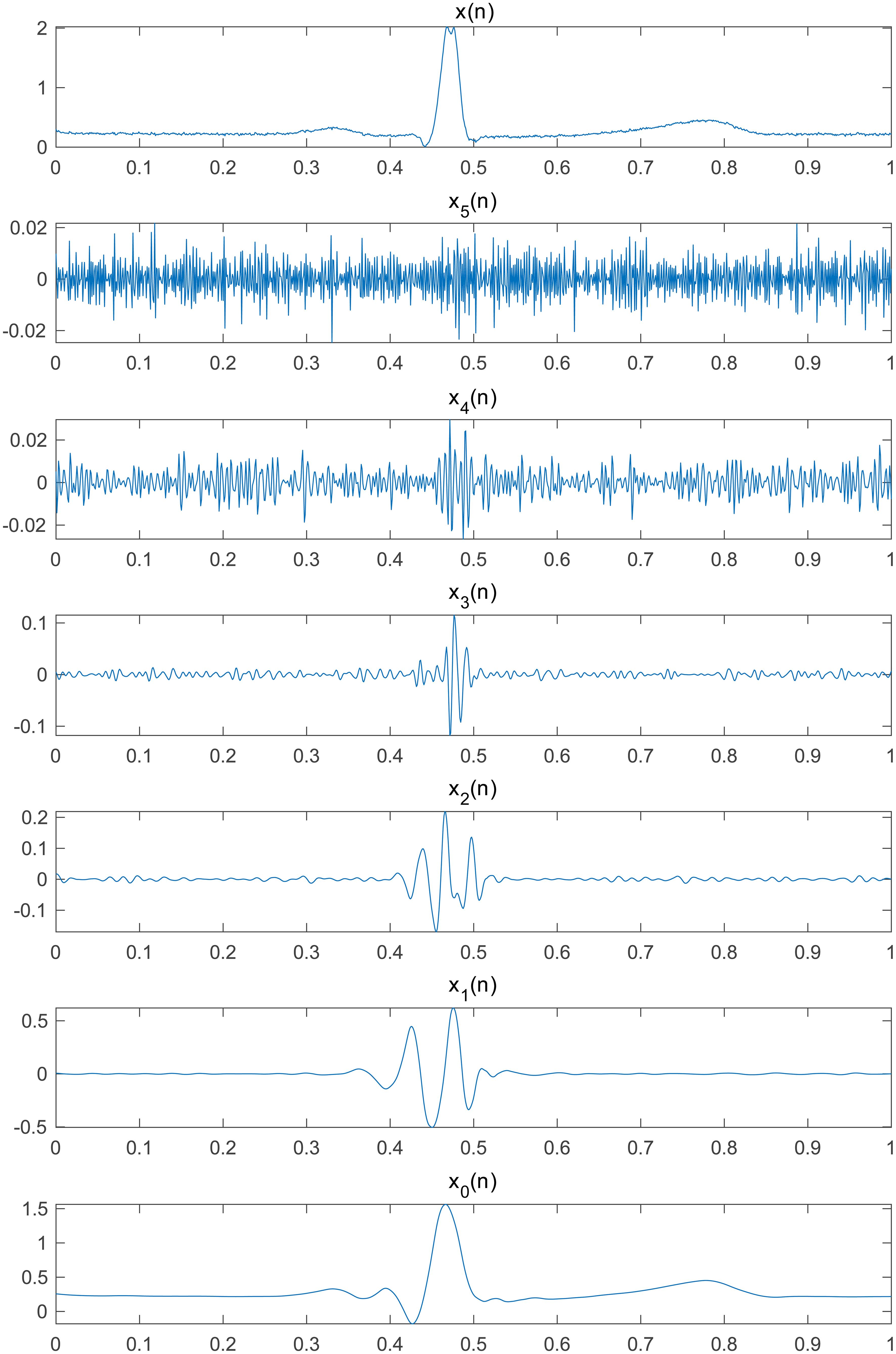Multiscale analysis of a 1s electrocardiogram segment using the discrete wavelet transform.