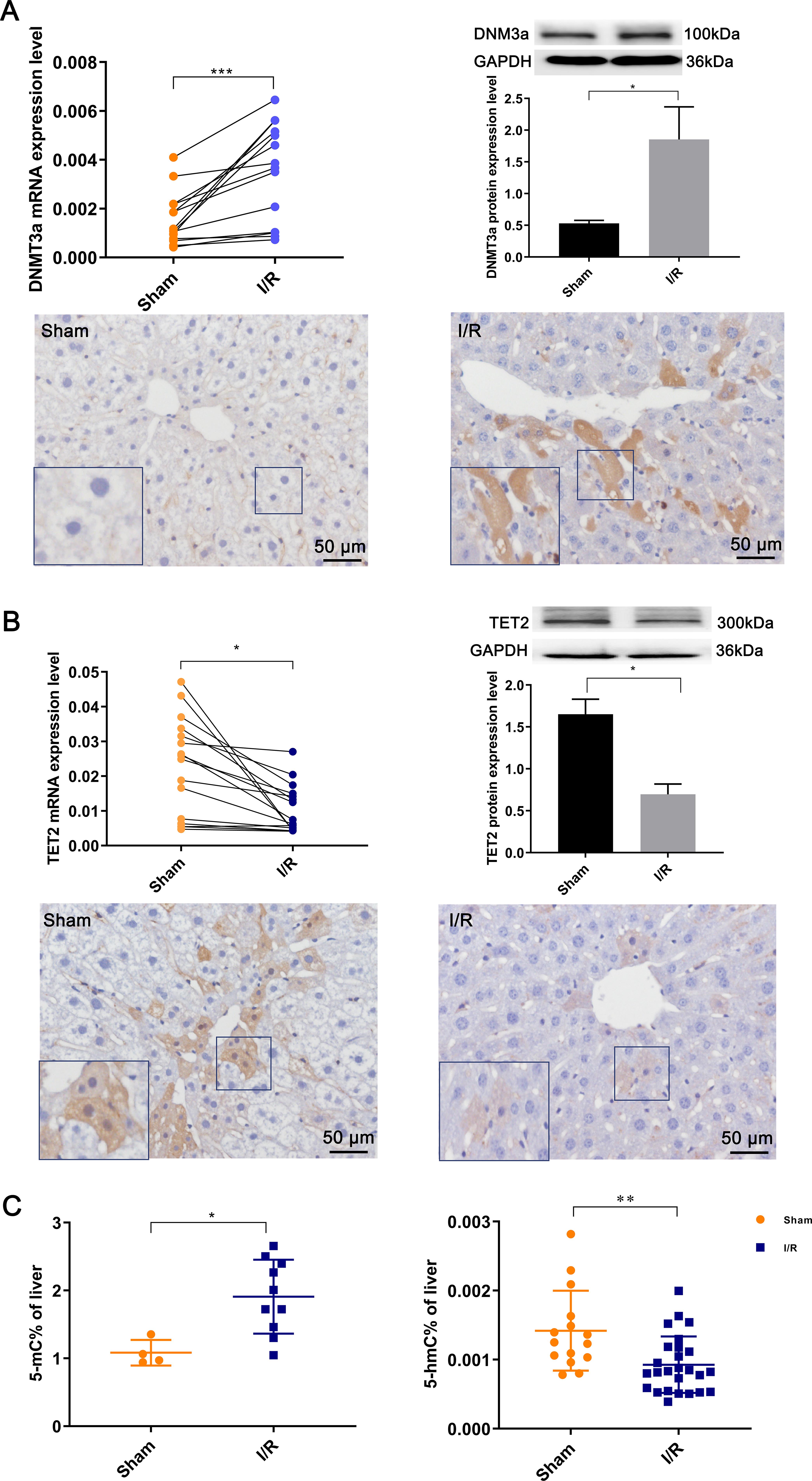 Global methylation levels after hepatic ischemia-reperfusion injury.