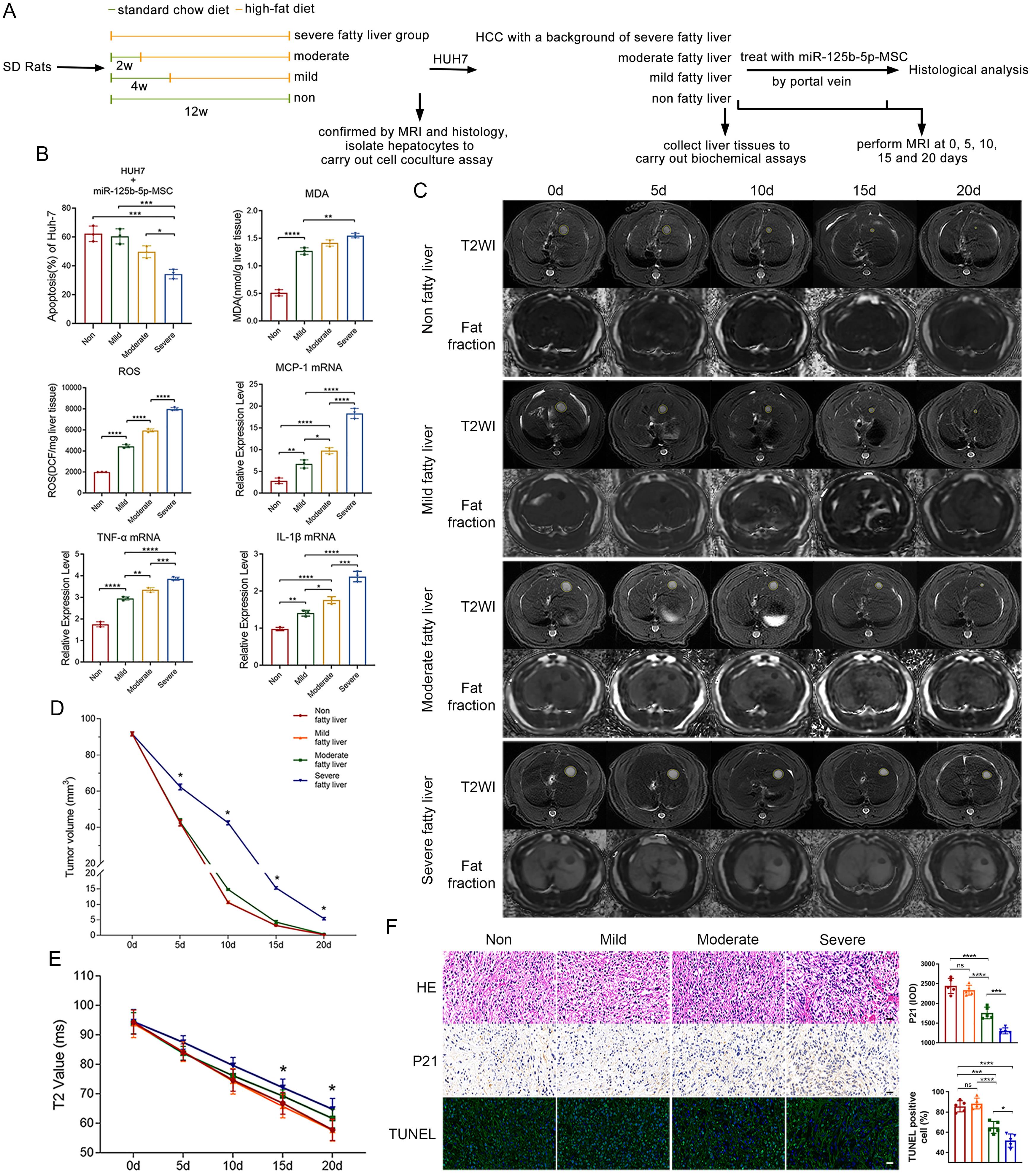 Effect of MASLD on the antitumor response to miR-125b-5p.