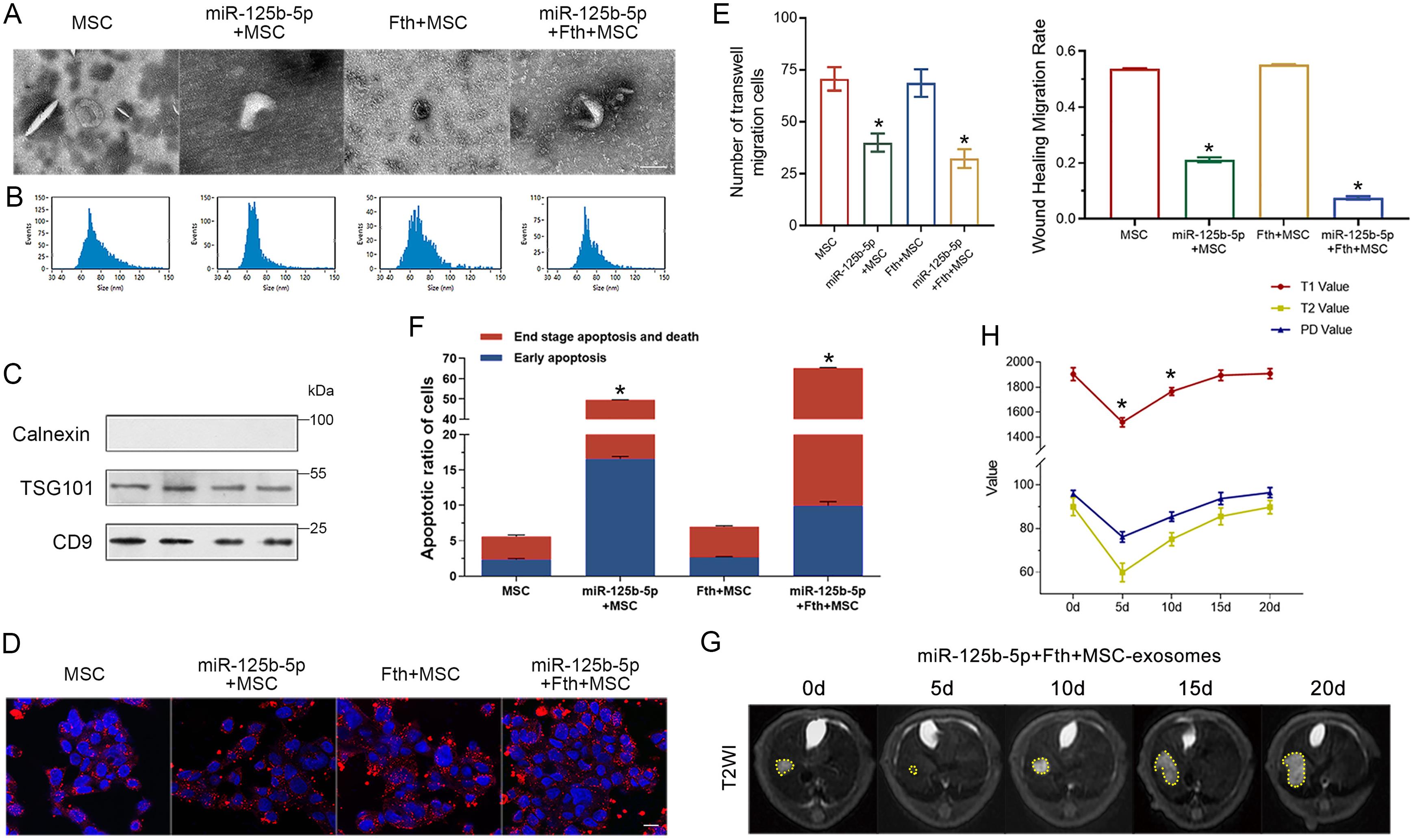 Characterization of MSC-Exos and evaluation of their antitumor effects <italic>in vitro</italic> and in an orthotopic HUH7 model.