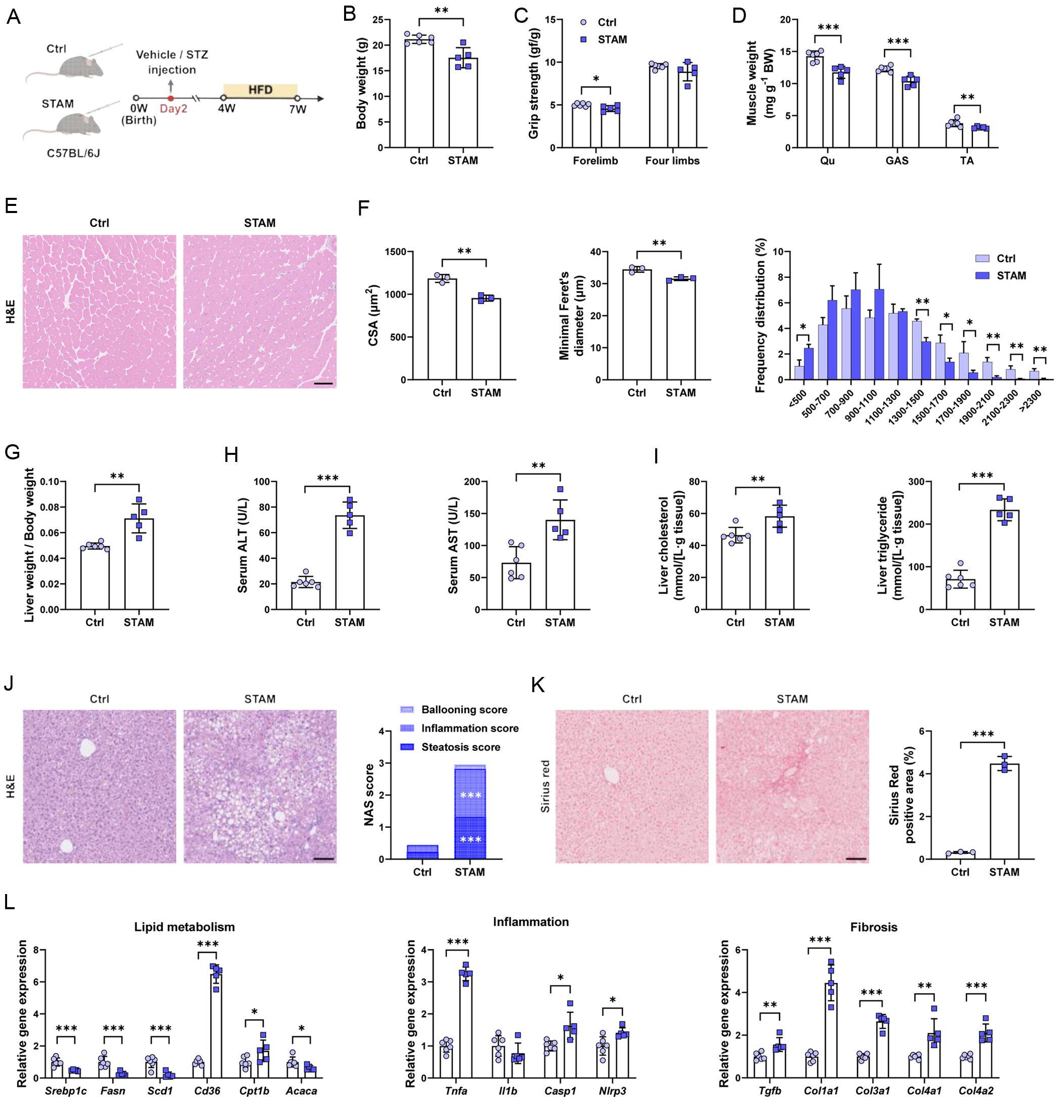 Assessment of sarcopenia- and MASLD-related parameters in STAM mice.