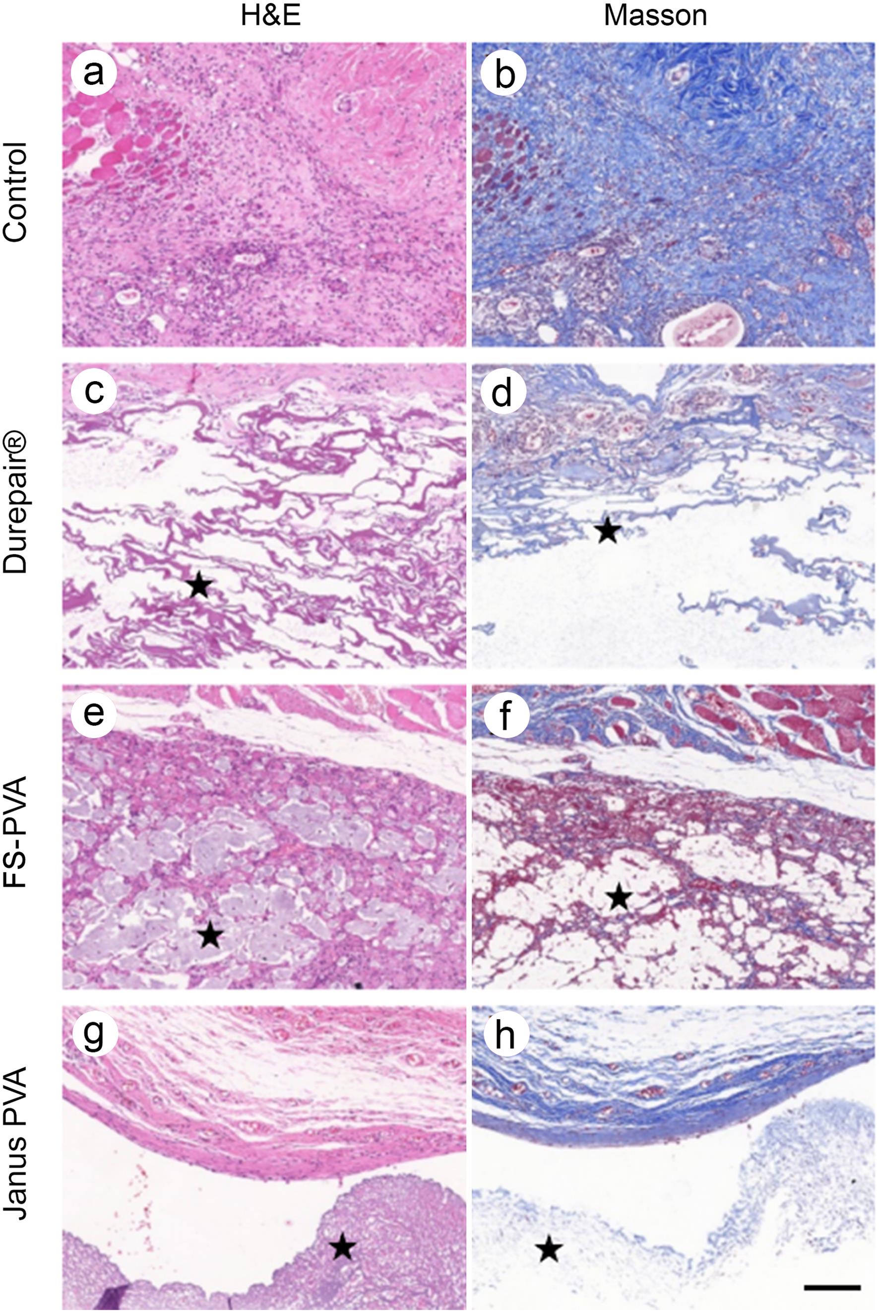 Results of rat subcutaneous implantation for 15 days.